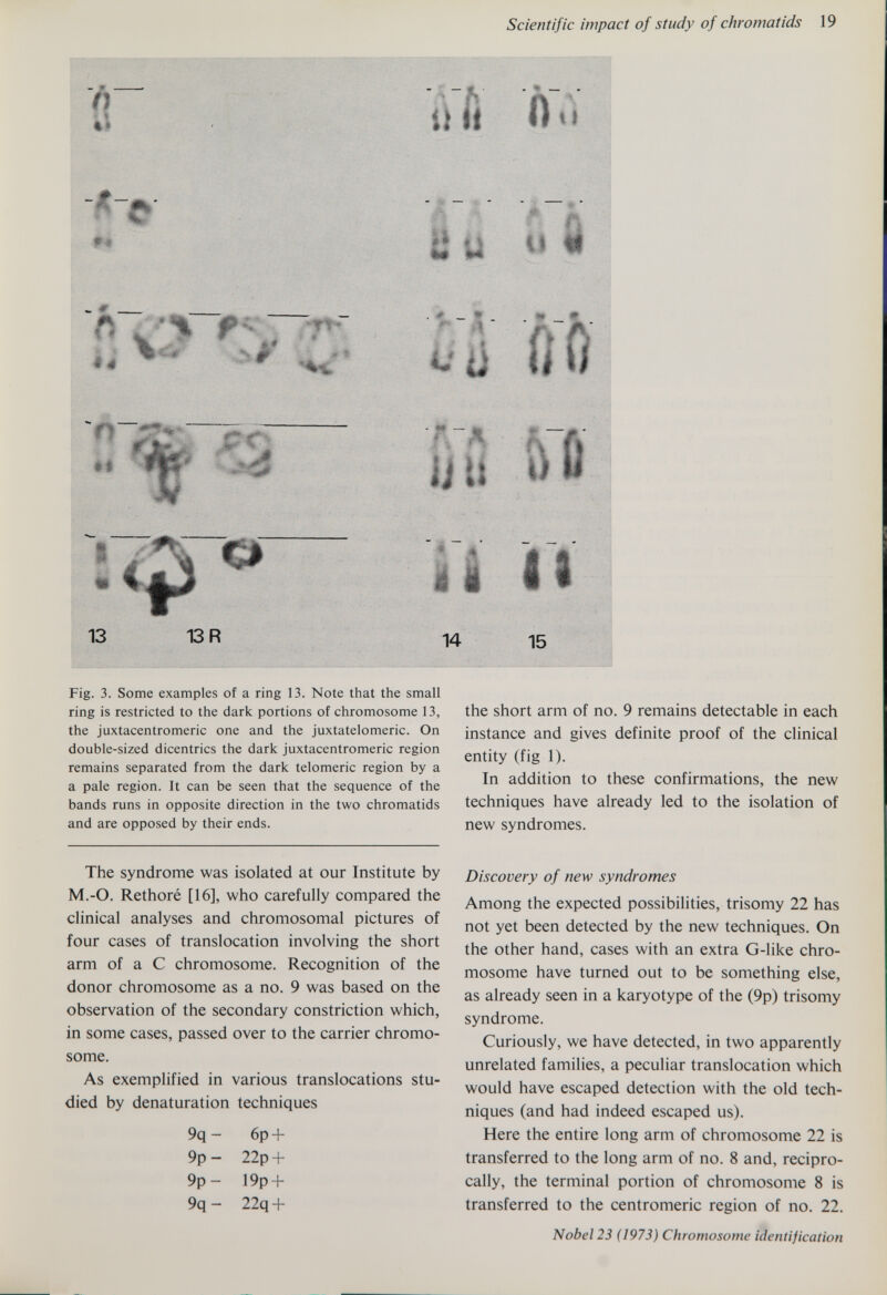 Scientific impact of study of chromatids 19 Fig. 3. Some examples of a ring 13. Note that the small ring is restricted to the dark portions of chromosome 13, the juxtacentromeric one and the juxtatelomeric. On double-sized dicentrics the dark juxtacentromeric region remains separated from the dark telomeric region by a a pale region. It can be seen that the sequence of the bands runs in opposite direction in the two chromatids and are opposed by their ends. the short arm of no. 9 remains detectable in each instance and gives definite proof of the clinical entity (fig 1). In addition to these confirmations, the new techniques have already led to the isolation of new syndromes. The syndrome was isolated at our Institute by M.-O. Rethoré [16], who carefully compared the clinical analyses and chromosomal pictures of four cases of translocation involving the short arm of a С chromosome. Recognition of the donor chromosome as a no. 9 was based on the observation of the secondary constriction which, in some cases, passed over to the carrier chromo¬ some. As exemplified in various translocations stu¬ died by denaturation techniques 9q - 6p + 9p - 22p + 9p- 19p + 9q- 22q + Discovery of new syndromes Among the expected possibiHties, trisomy 22 has not yet been detected by the new techniques. On the other hand, cases with an extra G-Hke chro¬ mosome have turned out to be something else, as already seen in a karyotype of the (9p) trisomy syndrome. Curiously, we have detected, in two apparently unrelated families, a peculiar translocation which would have escaped detection with the old tech¬ niques (and had indeed escaped us). Here the entire long arm of chromosome 22 is transferred to the long arm of no. 8 and, recipro¬ cally, the terminal portion of chromosome 8 is transferred to the centromeric region of no. 22. Nobel 23 ( 1973) Chromosome identification