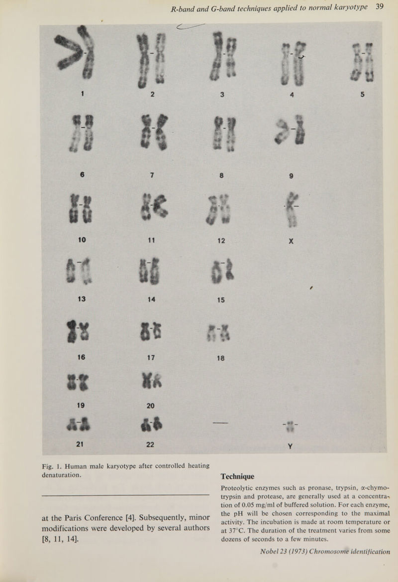 R-band and G-band techniques applied to normal karyotype 39 8 9 10 12 13 14 15 16 19 17 20 Щ. ~l 21 22 18 Fig. I. Human male karyotype after controlled heating denaturation. at the Paris Conference [4]. Subsequently, minor modifications were developed by several authors [8, 11, 14]. Technique Proteolytic enzymes such as pronase, trypsin, a-chymo- trypsin and protease, are generally used at a concentra-« tion of 0.05 mg/ml of buffered solution. For each enzyme, the pH will be chosen corresponding to the maximal activity. The incubation is made at room temperature or at 37°C. The duration of the treatment varies from some dozens of seconds to a few minutes. Nobel 23 (1973) Chromosome identification