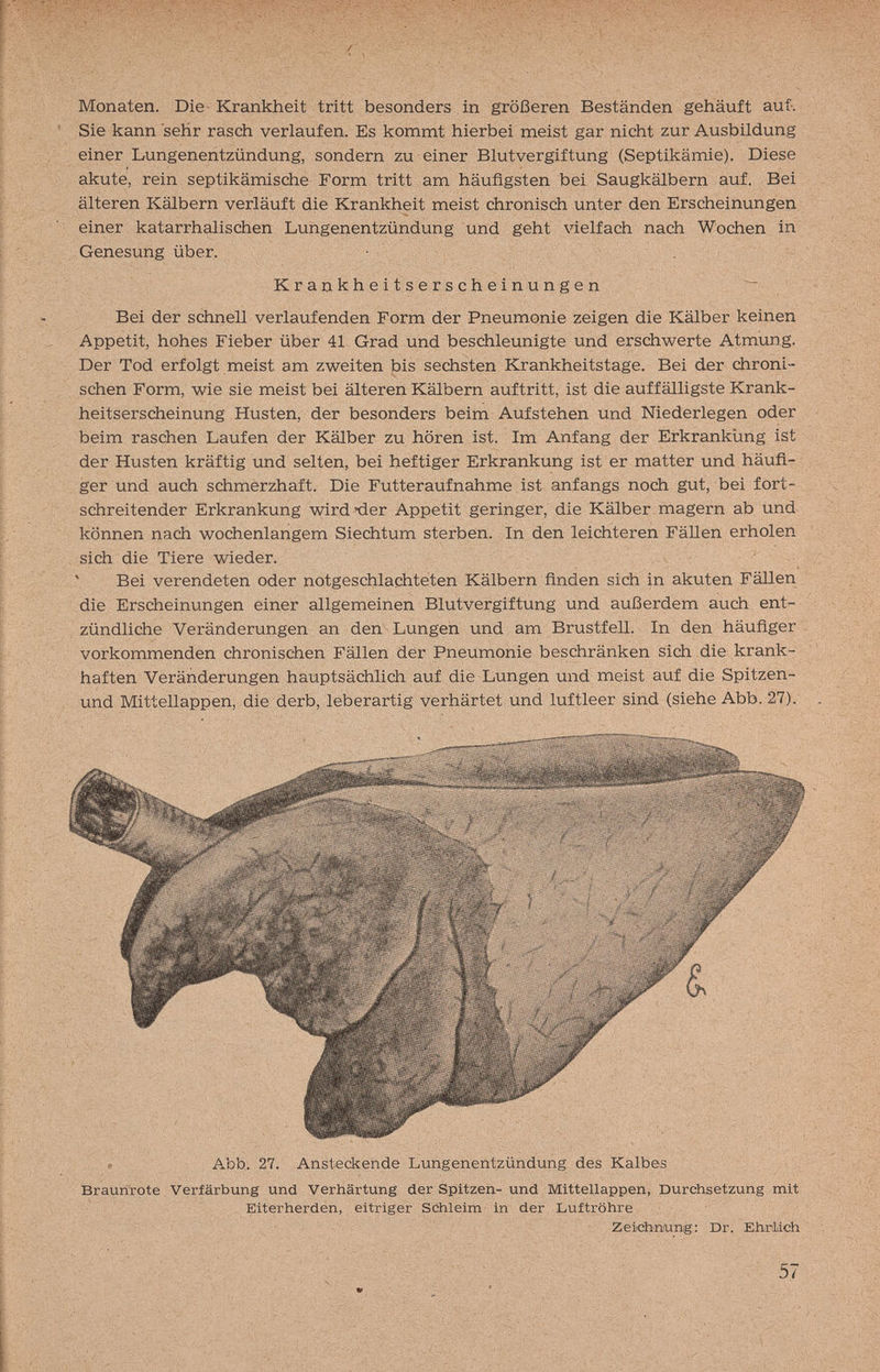 Monaten. Die Krankheit tritt besonders in größeren Beständen gehäuft aut. Sie kann sehr rasch verlaufen. Es kommt hierbei meist gar nicht zur Ausbildung einer Lungenentzündung, sondern zu einer Blutvergiftung (Septikämie). Diese akute, rein septikämische Form tritt am häufigsten bei Saugkälbern auf. Bei älteren Kälbern verläuft die Krankheit meist chronisch unter den Erscheinungen einer katarrhalischen Lungenentzündung und geht vielfach nach Wochen in Genesung über. Bei der schnell verlaufenden Form der Pneumonie zeigen die Kälber keinen Appetit, hohes Fieber über 41 Grad und beschleunigte und erschwerte Atmung. Der Tod erfolgt meist am zweiten bis sechsten Krankheitstage. Bei der chroni¬ schen Form, wie sie meist bei älteren Kälbern auftritt, ist die auffälligste Krank¬ heitserscheinung Husten, der besonders beim Aufstehen und Niederlegen oder beim raschen Laufen der Kälber zu hören ist. Im Anfang der Erkrankung ist der Husten kräftig und selten, bei heftiger Erkrankung ist er matter und häufi¬ ger und auch schmerzhaft. Die Futteraufnahme ist anfangs noch gut, bei fort¬ schreitender Erkrankung wird-der Appetit geringer, die Kälber magern ab und können nach wochenlangem Siechtum sterben. In den leichteren Fällen erholen sich die Tiere wieder. Bei verendeten oder notgeschlaehteten Kälbern finden sich in akuten Fällen die Erscheinungen einer allgemeinen Blutvergiftung und außerdem auch ent¬ zündliche Veränderungen an den Lungen und am Brustfell. In den häufiger vorkommenden chronischen Fällen der Pneumonie beschränken sich die krank¬ haften Veränderungen hauptsächlich auf die Lungen und meist auf die Spitzen- und MittelLappen, die derb, leberartig verhärtet und luftleer sind (siehe Abb. 27). , . Abb. 27. Ansteckende Lungenentzündung des Kalbes Brauiirote Verfärbung und Verhärtung der Spitzen- und Mittellappen, Durchsetzung mit Eiterherden, eitriger Schleim in der Luftröhre Krankheitserscheinungen Zeichniung; Dr. Ehrlich