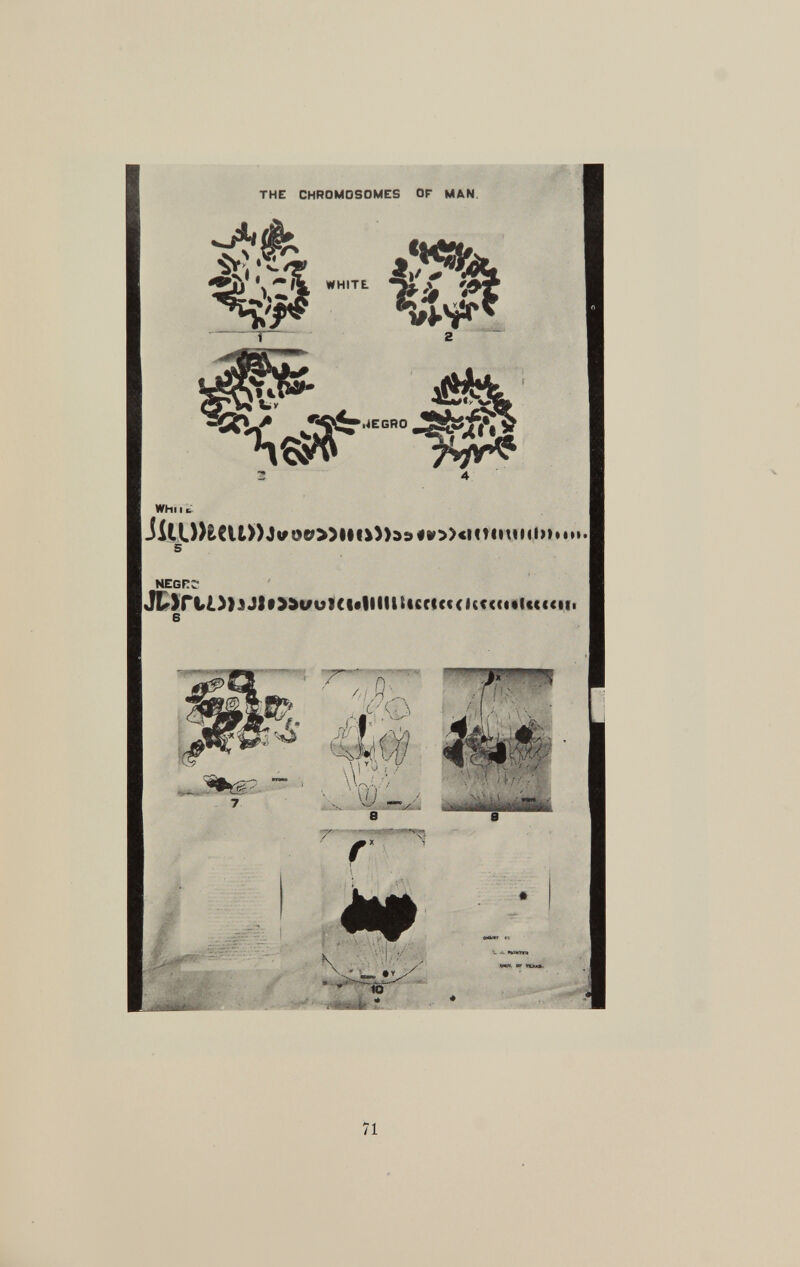 the chromosomes or man whu i |JilO)tCU»Jvt«&»IM*))3:»4ao)<mintHl» negft; 6 -1»»— 4S ; ^ 2... » Lfk,\ /• j,;f r -a $ ' ~ - . \ > r \ u J < 7 \W, '/ / r ' r ' *# • » . ■'(«•Afc''.» • V - -, »»11.W»