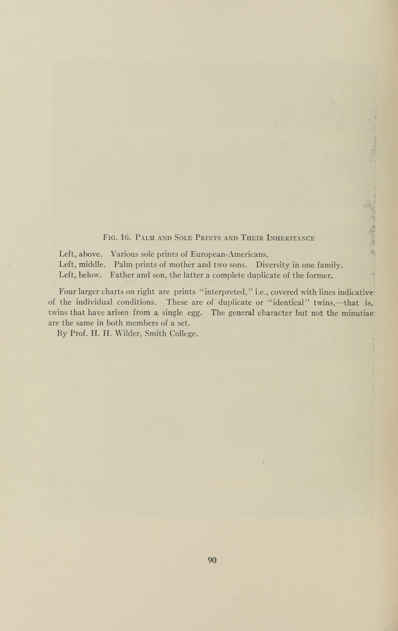 Fig. 16. Palm and Sole Prints and Their Inheritance Left, above. Various sole prints of European-Americans. Left, middle. Palm prints of mother and two sons. Diversity in one family. Left, below. Father and son, the latter a complete duplicate of the former. Four larger charts on right are prints interpreted, i.e., covered with lines indicative of the individual conditions. These are of duplicate or identical twins,—that is, twins that have arisen from a single egg. The general character but not the minutiae are the same in both members of a set. By Prof. H. H. Wilder, Smith College.