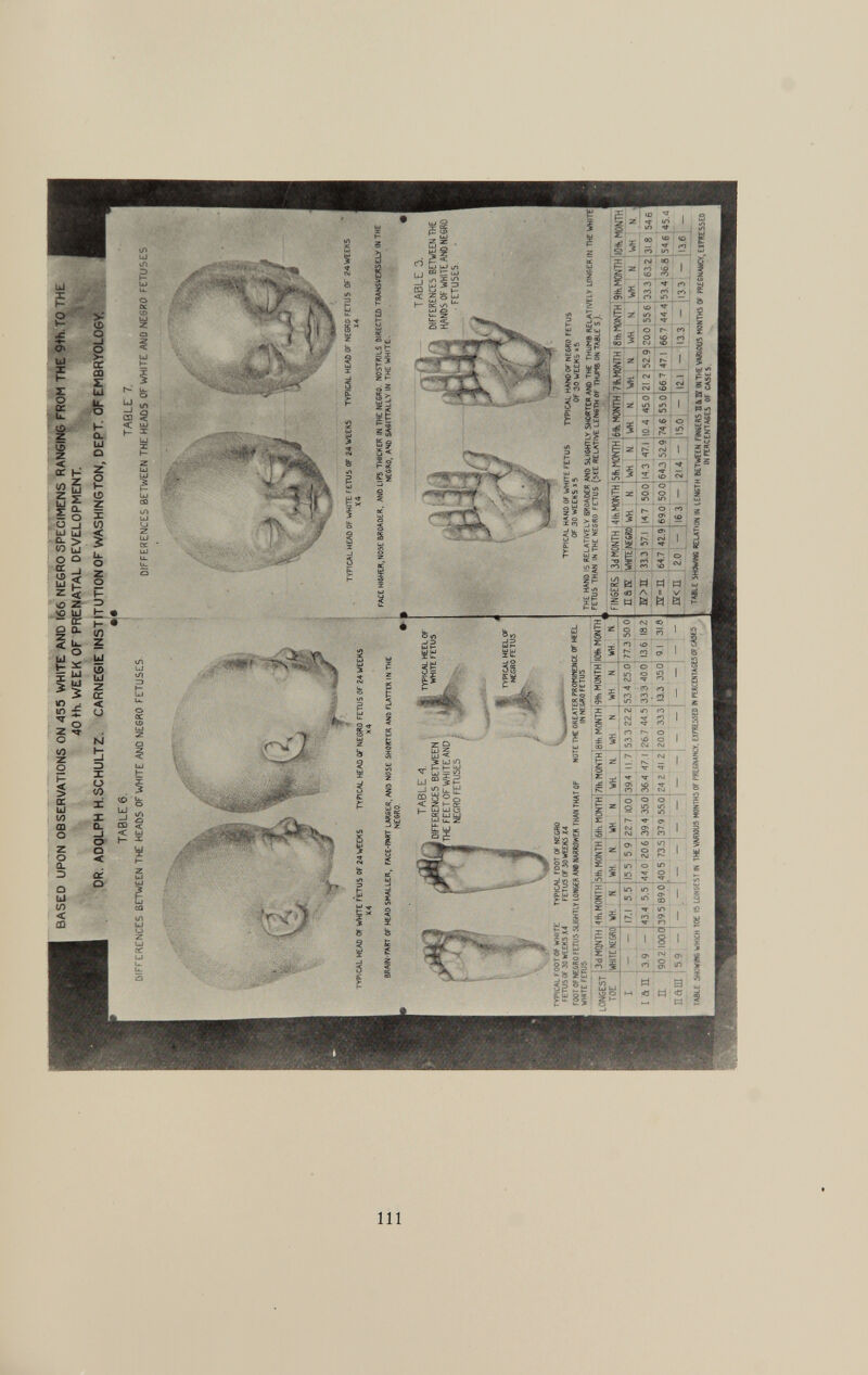 BASED UPON OBSERVATIONS ON 455 WHITE AND 166 NEGRO SPECIMENS RANGING FROM THE ÇHh.TO THE 40 th WEEK OF PRENATAL DEVELOPMENT. DR. ADOLPH H. SCHULTZ CARNEGIE INSTITUTION OF WASHINGTON, DEPT. OF EMBRYOLOGY, TABLE 6. DIFFERENCES BETWEEN TIC HEAPS OF WHITE AND NESR0 FETUSES TABLE 7. DIFFERENCES BETWEEN THE HEADS OF WHITE ANO NESfW FETUSES TYF1CAL «CAB OF WHITE FETUS OF 24WEESS TVPlCAt. HEAD Of NESSO FET j5 OF «-»WEEKS *4 « FACE WHO! «OSE BMAMK, AMI UPS THICKER IN THE MESSO NOSTRILS aiRECTED TRANSVERSELY « T« NEWS, ANO SASHTAUY W THE WHITE. TABLE 3. DIFFERENCES BETWEEN THE HWÎS OF WHITE MB NEGRO • FETUSES TYPICAL HANO Of WHITE FETUS TYPICAL HANOOf HECHO f£T US OF 30 WEEKS * 5 OF 30 WEEKS t S * £ (- ative t v ®WAOfs ano SLIGHT tv SHORTER A«» THE THUN8 relatively wt Et IN THE WHITE FETUS THAN in THE NESSO FETUS (SEE RELATIVE LENéTHOF THUM» on TABLE s '). FINSERS 3d MONTH ; 4tKM0NTH 5 a ® writ NE«0. WH. N E>E 333 57.1 14 7 500 BT-E 64.7 42,9 690 500 2.0 ¡16 3 5fti MONTH !6ik MONTH 7fcM0NTH _ gtt, t«NTH 9th.M0NTH (Oft. MONITt WH N WH N WK R WH N WH H WH N 14.3 17.1 10 4 450 21 2 529 :00 556 333 632 31 8 546 643 52.9:74 6 5 5 0 21,4 - ÌI5.0 - 667 471 667 44 4 53.4 36.8 546 45.4 121 — 13.3 - ; 13 3 — 136 TABLE SHOWWS RELATION IN LENGTH BETWEEN FW«RS I IS IN THE VM00U5 MONTHS OF fKtCNAKrf EÏPRtSSEO IN PERCENT ASES OF CASES '