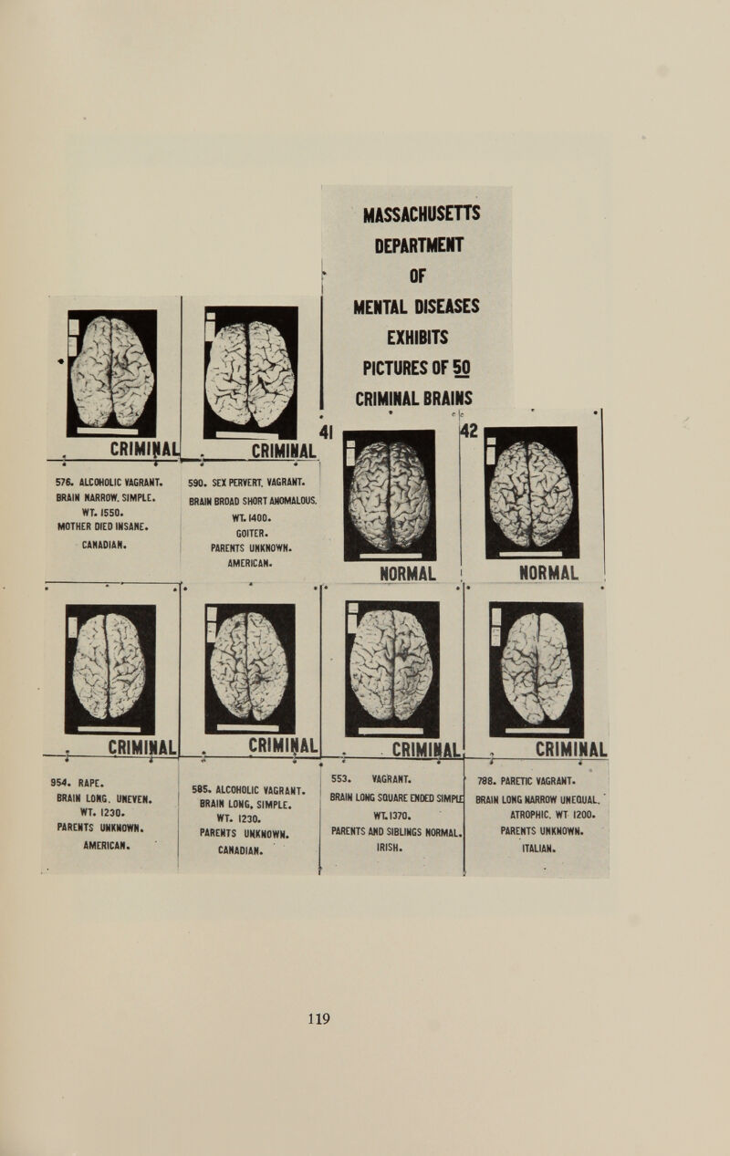 CRIMINAL 41 CRIMINAL 576. ALCOHOLIC VAGRANT. BRAIN NARROW. SIMPLE. WT. 1550. MOTHER DIED INSANE. CANADIAN. 590. SEX PERVERT. VAGRANT. BRAIN BROAD SHORT ANOMALOUS. WT. 1400. GOITER. PARENTS UNKNOWN. AMERICAN. CRIMINAL —j_ 954. RAPE. BRAIN LONG. UNEVEN. WT. 1230. PARENTS UNKNOWN. AMERICAN. CRIMINAL MASSACHUSETTS DEPARTMENT OF MENTAL DISEASES EXHIBITS PICTURES OF 50 CRIMINAL BRAINS * e je 42 NORMAL CRIMINAL NORMAL CRIMINAL 585. ALCOHOLIC VAGRANT. BRAIN LONG. SIMPLE. WT. 1230. PARENTS UNKNOWN. CANADIAN. 553. VAGRANT. BRAIN LONG SQUARE ENDED SIMPLE WT.I370. PARENTS AND SIBLINGS NORMAL IRISH. 788. PARETIC VAGRANT. BRAIN LONG NARROW UNEQUAL. ATROPHIC. WT 1200. PARENTS UNKNOWN. ITALIAN.