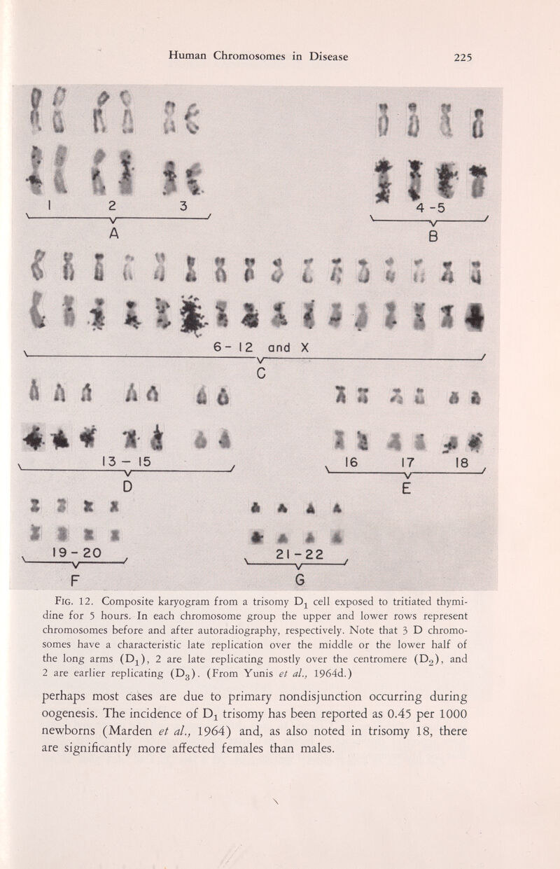 Human Chromosomes in Disease 225 P. f f S i (î Û ! s ! 3 г « i : r, i à (ti Ui > I 6-12 and X V ^ h h й il й é ж Ш ш mm é-A M è 4 * i ß§ 3 - 15 —V 16 17 -V- 18 D S I к I i i ш а 19-20 s/ è A à è Ш A è Ш 21-22 » . Fig. 12. Composite karyogram from a trisomy cell exposed to tritiated thymi¬ dine for 5 hours. In each chromosome group the upper and lower rows represent chromosomes before and after autoradiography, respectively. Note that 3 D chromo¬ somes have a characteristic late replication over the middle or the lower half of the long arms (Dj), 2 are late replicating mostly over the centromere (Do), and 2 are earlier replicating (Dg). (From Yunis el al., 1964d.) perhaps most cases are due to primary nondisjunction occurring during oogenesis. The incidence of trisomy has been reported as 0.45 per 1000 newborns (Harden et al., 1964) and, as also noted in trisomy 18, there are significantly more affected females than males. \