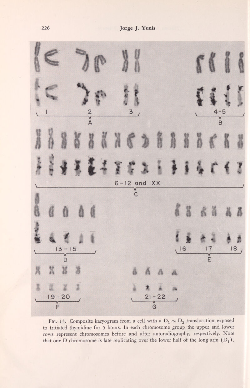 226 Jorge J. Yunis I 1. ^ Ш Ш m И îi nini f t 6-12 and XX 4-5 В r I ti ii ti 13 - 15 —V—  D il 19-20 У — F 16 è á ê á, è Ш' 1 ш \ 21-22 . \ у J G 17 i8 Fig. 13. Composite karyogram from a cell with a Dg translocation exposed to tritiated thymidine for 5 hours. In each chromosome group the upper and lower rows represent chromosomes before and after autoradiography, respectively. Note that one D chromosome is late replicating over the lower half of the long arm (D^),