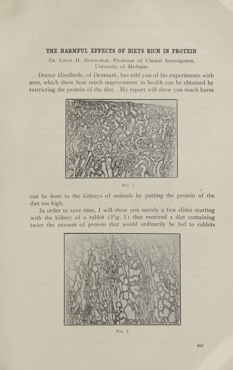 THE HARMFUL EFFECTS OF DIETS RICH IN PROTEIN Dr. Louis H. Newburgh, Professor of Clinical Investigation, University of Michigan Doctor Hindhede, of Denmark, has told you of his experiments with men, which show how much improvement in health can be obtained by restricting the protein of the diet. My report will show you much harm Fig. 1 can be done to the kidneys of animals by putting the protein of the diet too high. In order to save time, I will show you merely a few slides starting with the kidney of a rabbit (Fig. 1) that received a diet containing twice the amount of protein that would ordinarily be fed to rabbits Fig. 2 407