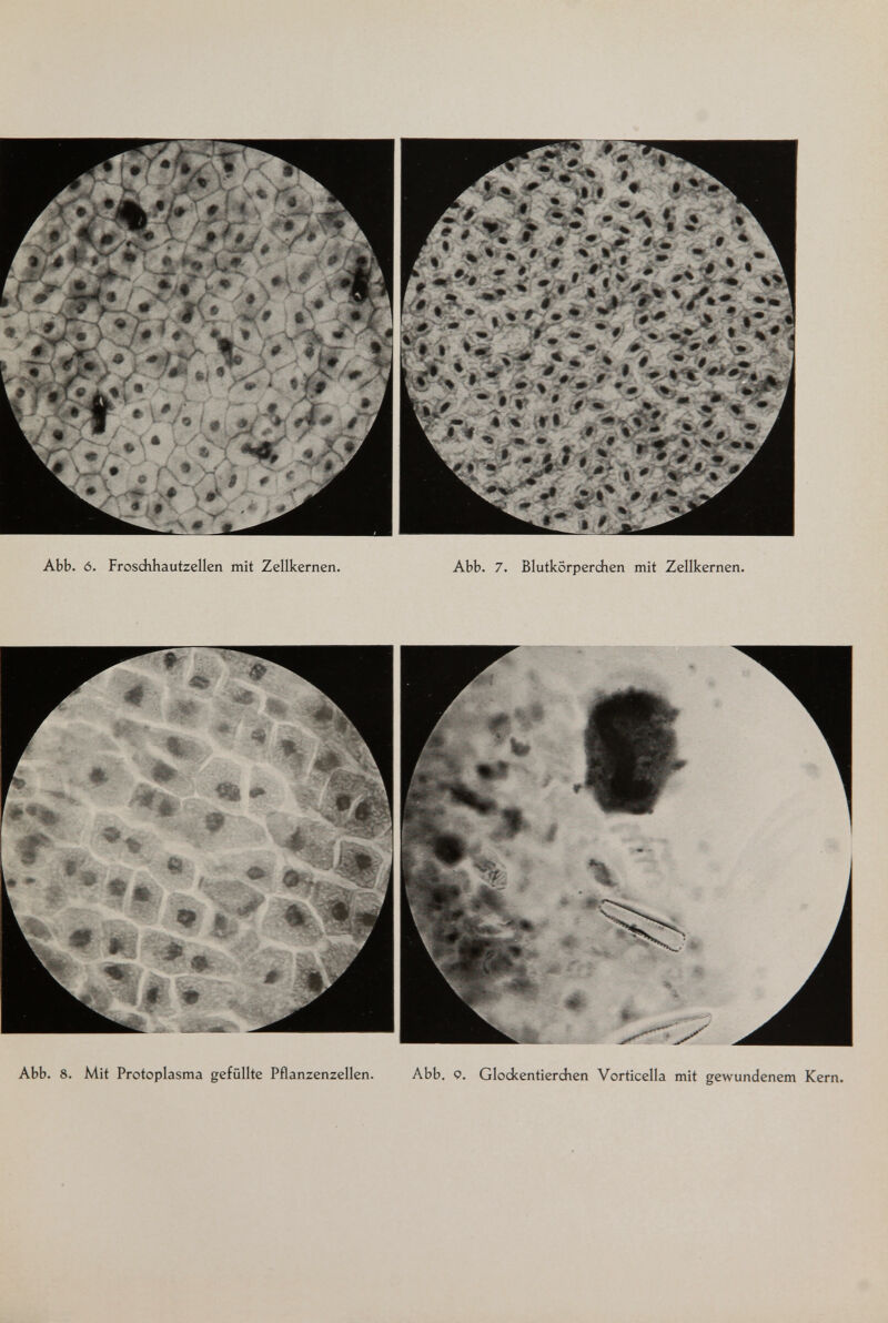 Abb. 6. Frosdihautzellen mit Zellkernen. Abb. 7. Blutkörperdien mit Zellkernen. Abb. 8. Mit Protoplasma gefüllte Pflanzenzellen. Abb. 9. Glodcentierdien Vorticella mit gewundenem Kern.