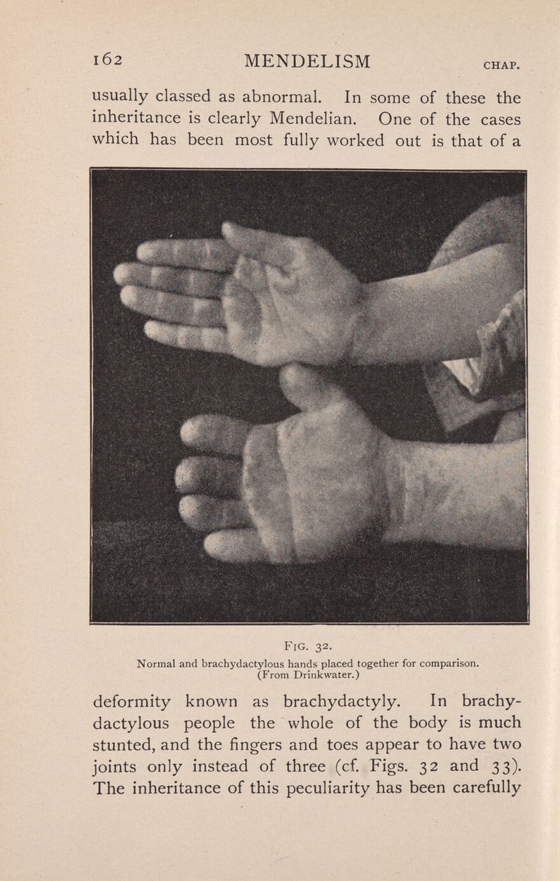 1б2 MENDELISM CHAP. usually classed as abnormal. In some of these the inheritance is clearly Mendelian. One of the cases which has been most fully worked out is that of a Fig. 32. Normal and brachydactylous hands placed together for comparison. (From Drinkwater.) deformity known as brachydactyly. In brachy¬ dactylous people the whole of the body is much stunted, and the fingers and toes appear to have two joints only instead of three (cf. Figs. 32 and 33). The inheritance of this peculiarity has been carefully