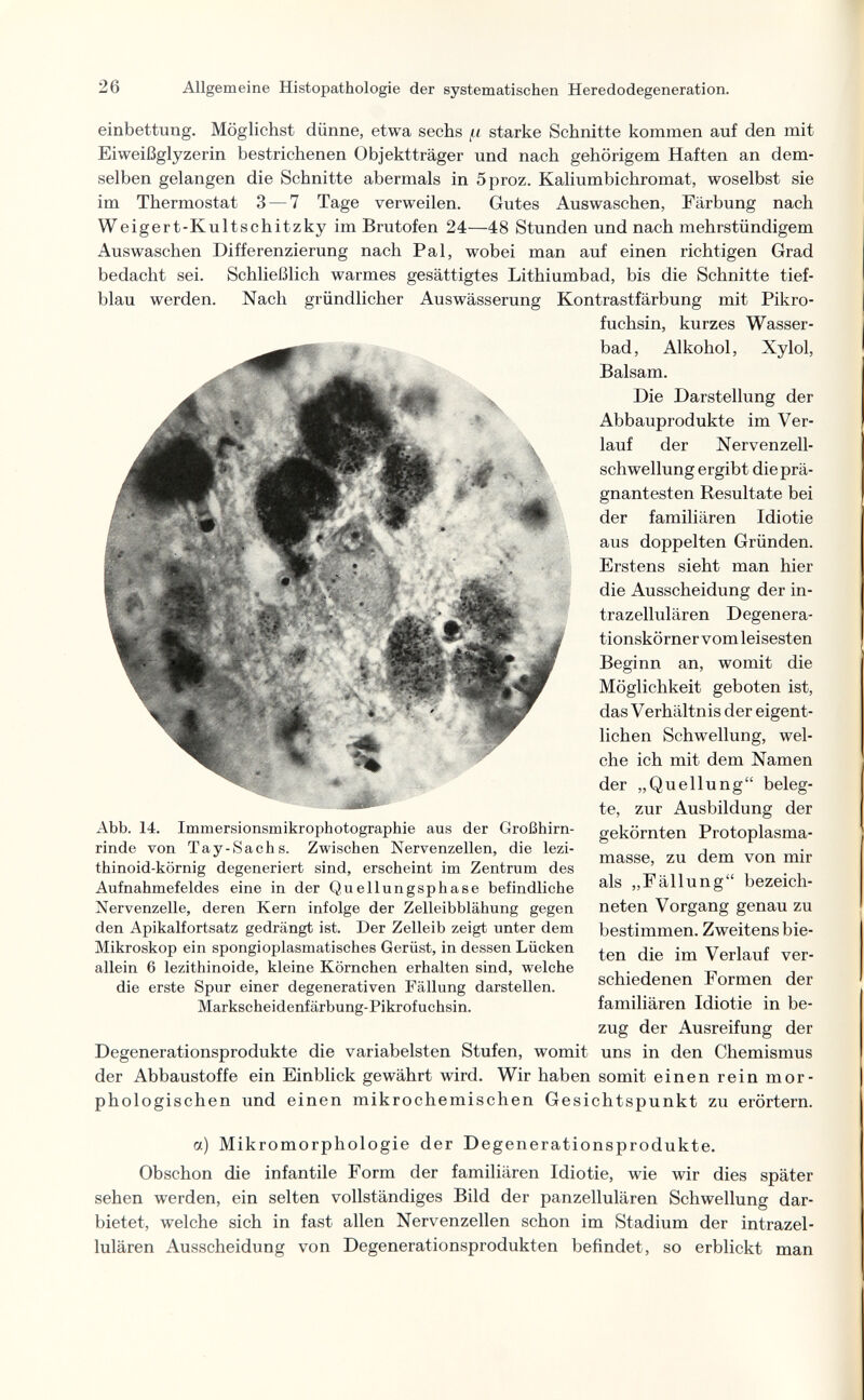 26 Allgemeine Histopathologie der systematischen Heredodegeneration. einbettung. Möglichst dünne, etwa sechs (.i starke Schnitte kommen auf den mit Eiweißglyzerin bestrichenen Objektträger und nach gehörigem Haften an dem¬ selben gelangen die Schnitte abermals in 5proz. Kaliumbichromat, woselbst sie im Thermostat 3 — 7 Tage verweilen. Gutes Auswaschen, Färbung nach Weigert-Kultschitzky im Brutofen 24—48 Stunden und nach mehrstündigem Auswaschen Differenzierung nach Pal, wobei man auf einen richtigen Grad bedacht sei. Schließlich warmes gesättigtes Lithiumbad, bis die Schnitte tief¬ blau werden. Nach gründlicher Aus Wässerung Kontrastfärbung mit Pikro- fuchsin, kurzes Wasser¬ bad, Alkohol, Xylol, Balsam. Die Darstellung der Abbauprodukte im Ver¬ lauf der Nervenzell¬ schwellung ergibt die prä¬ gnantesten Resultate bei der familiären Idiotie aus doppelten Gründen. Erstens sieht man hier die Ausscheidung der in¬ trazellulären Degenera¬ tionskörner vom leisesten Beginn an, womit die Möglichkeit geboten ist, das Verhältnis der eigent¬ lichen Schwellung, wel¬ che ich mit dem Namen der „Quellung beleg¬ te, zur Ausbildung der gekörnten Protoplasma¬ masse, zu dem von mir als „Fällung bezeich¬ neten Vorgang genau zu bestimmen. Zweitens bie¬ ten die im Verlauf ver¬ schiedenen Formen der familiären Idiotie in be- zug der Ausreifung der Degenerationsprodukte die variabelsten Stufen, womit uns in den Chemismus der Abbaustoffe ein Einblick gewährt wird. Wir haben somit einen rein mor- phol ogischen und einen mikrochemischen Gesichtspunkt zu erörtern. Abb. 14. Immersionsmikrophotographie aus der Großhirn¬ rinde von Tay-Sachs. Zwischen Nervenzellen, die lezi- thinoid-körnig degeneriert sind, erscheint im Zentrum des Aufnahmefeldes eine in der Quellungsphase befindliche Nervenzelle, deren Kern infolge der Zelleibblähung gegen den Apikaifortsatz gedrängt ist. Der Zelleib zeigt unter dem Mikroskop ein spongioplasmatisches Gerüst, in dessen Lücken allein 6 lezithinoide, kleine Körnchen erhalten sind, welche die erste Spur einer degenerativen Fällung darstellen. Markscheidenfärbung-Pikrofuchsin. a) Mikromorphologie der Degenerationsprodukte. Obschon die infantile Form der familiären Idiotie, wie wir dies später sehen werden, ein selten vollständiges Bild der panzellulären Schwellung dar¬ bietet, welche sich in fast allen Nervenzellen schon im Stadium der intrazel¬ lulären Ausscheidung von Degenerationsprodukten befindet, so erblickt man