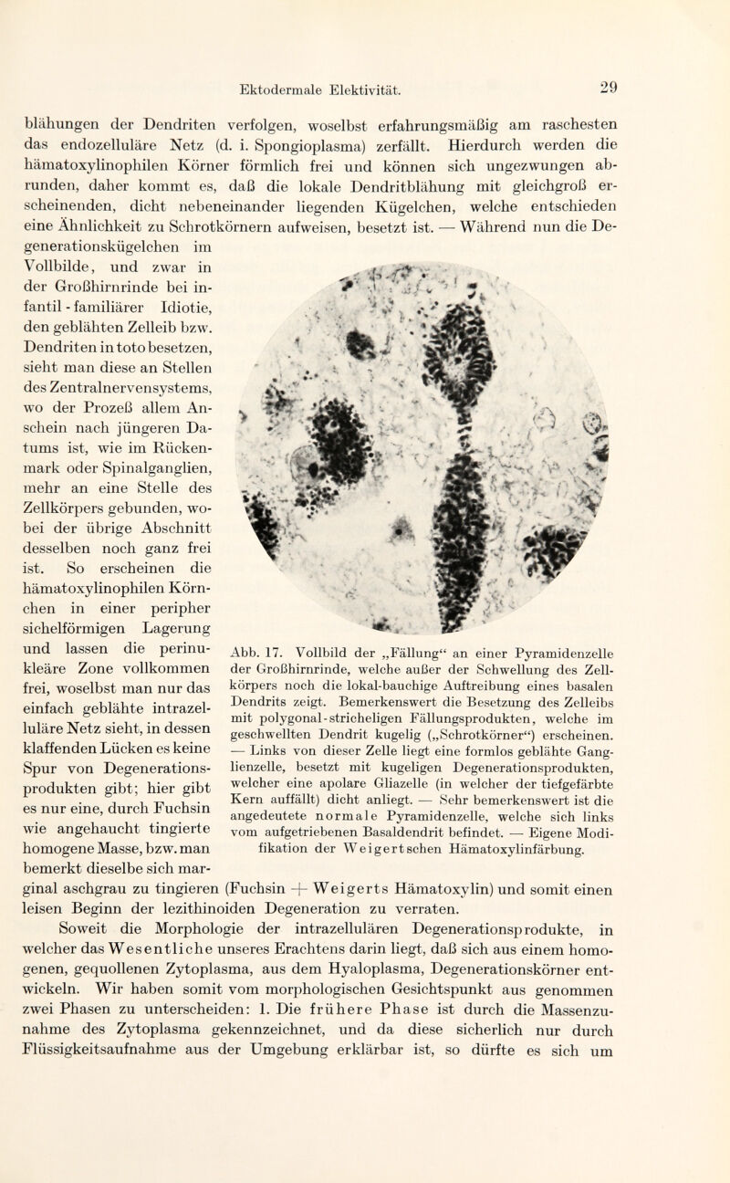 Ektodermale Elektivität. 29 blähungen der Dendriten verfolgen, woselbst erfahrungsmäßig am raschesten das endozelluläre Netz (d. i. Spongioplasma) zerfällt. Hierdurch werden die hämatoxylinophilen Körner förmlich frei und können sich ungezwungen ab¬ runden, daher kommt es, daß die lokale Dendritblähung mit gleichgroß er¬ scheinenden, dicht nebeneinander liegenden Kügelchen, welche entschieden eine Ähnlichkeit zu Schrotkörnern aufweisen, besetzt ist. — Während nun die De- generationskügelchen im Vollbilde, und zwar in der Großhirnrinde bei in¬ fantil - familiärer Idiotie, den geblähten Zelleib bzw. Dendriten in toto besetzen, sieht man diese an Stellen des Zentralnervensystems, wo der Prozeß allem An¬ schein nach jüngeren Da¬ tums ist, wie im Rücken¬ mark oder Spinalganglien, mehr an eine Stelle des Zellkörpers gebunden, wo¬ bei der übrige Abschnitt desselben noch ganz frei ist. So erscheinen die hämatoxylinophilen Körn¬ chen in einer peripher sichelförmigen Lagerung und lassen die perinu¬ kleäre Zone vollkommen frei, woselbst man nur das einfach geblähte intrazel¬ luläre Netz sieht, in dessen klaffenden Lücken es keine Spur von Degenerations¬ produkten gibt; hier gibt es nur eine, durch Fuchsin wie angehaucht tingierte homogene Masse, bzw. man bemerkt dieselbe sich mar¬ ginal aschgrau zu tingieren (Fuchsin + Weigerts Hämatoxylin) und somit einen leisen Beginn der lezithinoiden Degeneration zu verraten. Soweit die Morphologie der intrazellulären Degenerationsprodukte, in welcher das Wesentliche unseres Erachtens darin liegt, daß sich aus einem homo¬ genen, gequollenen Zytoplasma, aus dem Hyaloplasma, Degenerationskörner ent¬ wickeln. Wir haben somit vom morphologischen Gesichtspunkt aus genommen zwei Phasen zu unterscheiden: L Die frühere Phase ist durch die Massenzu¬ nahme des Zytoplasma gekennzeichnet, und da diese sicherlich nur durch Flüssigkeitsaufnahme aus der Umgebung erklärbar ist, so dürfte es sich um Abb. 17. Vollbild der „Fällung an einer Pyramidenzelle der Großhirnrinde, welche außer der Schwellung des Zell- körpers noch die lokal-bauchige Auftreibung eines basalen Dendrits zeigt. Bemerkenswert die Besetzung des Zelleibs mit polygonal-Stricheligen Fällungsprodukten, welche im geschwellten Dendrit kugelig („Schrotkörner) erscheinen. — Links von dieser Zelle liegt eine formlos geblähte Gang¬ lienzelle, besetzt mit kugeligen Degenerationsprodukten, welcher eine apolare Gliazelle (in welcher der tiefgefärbte Kern auffällt) dicht anliegt. — Sehr bemerkenswert ist die angedeutete normale Pyramidenzelle, welche sich links vom aufgetriebenen Basaldendrit befindet. — Eigene Modi¬ fikation der Weigert sehen Hämatoxylinfärbung.