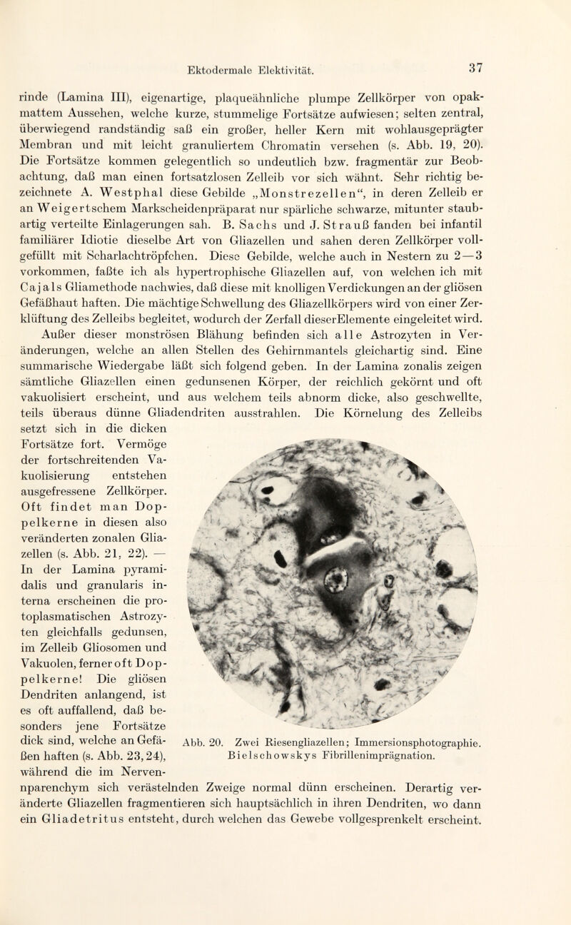 Ektodermale Elektivität. 37 rinde (Lamina III), eigenartige, plaqueähnliehe plumpe Zellkörper von opak¬ mattem Aussehen, welche kurze, stummelige Fortsätze aufwiesen; selten zentral, überwiegend randständig saß ein großer, heller Kern mit wohlausgeprägter Membran und mit leicht granuliertem Chromatin versehen (s. Abb. 19, 20). Die Fortsätze kommen gelegentlich so undeutlich bzw. fragmentär zur Beob¬ achtung, daß man einen fortsatzlosen Zelleib vor sich wähnt. Sehr richtig be¬ zeichnete A. Westphal diese Gebilde „Monstrezellen, in deren Zelleiber an Weigertschem Markscheidenpräparat nur spärliche schwarze, mitunter staub- artig verteilte Einlagerungen sah. B, Sachs und J. Strauß fanden bei infantil familiärer Idiotie dieselbe Art von Gliazellen und sahen deren Zellkörper voll¬ gefüllt mit Scharlachtröpfchen. Diese Gebilde, welche auch in Nestern zu 2—3 vorkommen, faßte ich als hypertrophische Gliazellen auf, von welchen ich mit Ca jais Gliamethode nachwies, daß diese mit knolligen Verdickungen an der gliösen Gefäßhaut haften. Die mächtige Schwellung des Gliazellkörpers wird von einer Zer¬ klüftung des Zelleibs begleitet, wodurch der Zerfall dieserElemente eingeleitet wird. Außer dieser monströsen Blähung befinden sich alle Astrozyten in Ver¬ änderungen, welche an allen Stellen des Gehirnmantels gleichartig sind. Eine summarische Wiedergabe läßt sich folgend geben. In der Lamina zonalis zeigen sämtliche Gliazellen einen gedunsenen Körper, der reichlich gekörnt und oft vakuolisiert erscheint, und aus welchem teils abnorm dicke, also geschwellte, teils überaus dünne Gliadendriten ausstrahlen. Die Körnelung des Zelleibs setzt sich in die dicken Fortsätze fort. Vermöge der fortschreitenden Va- kuolisierung entstehen ausgefressene Zellkörper. Oft findet man Dop¬ pelkerne in diesen also veränderten zonalen Glia¬ zellen (s. Abb. 21, 22). — In der Lamina pyrami¬ dalis und granulans in¬ terna erscheinen die pro¬ toplasmatischen Astrozy¬ ten gleichfalls gedunsen, im Zelleib Gliosomen und V akuolen, fern eroftDop- pelkerne! Die gliösen Dendriten anlangend, ist es oft auffallend, daß be¬ sonders jene Fortsätze dick sind, welche anGefä- Abb. 20. Zwei Riesengliazellen ; Immersionsphotographie. ßen haften (s. Abb. 23,24), Bielschowskys Fibrillenimprägnation. während die im Nerven- nparenchym sich verästelnden Zweige normal dünn erscheinen. Derartig ver¬ änderte Gliazellen fragmentieren sich hauptsächlich in ihren Dendriten, wo dann ein Gliadetritus entsteht, durch welchen das Gewebe vollgesprenkelt erscheint.