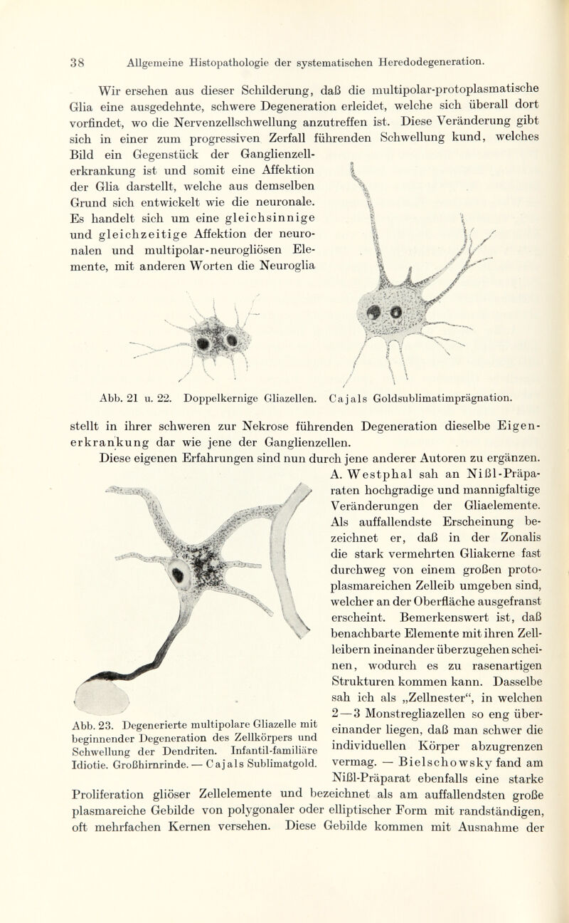 38 Allgemeine Histopathologie der systematischen Heredodegeneration. Wir ersehen aus dieser Schilderung, daß die multipolar-protoplasmatische Glia eine ausgedehnte, schwere Degeneration erleidet, welche sich überall dort vorfindet, wo die Nervenzellschwellung anzutreffen ist. Diese Veränderung gibt sich in einer zum progressiven Zerfall führenden Schwellung kund, welches Bild ein Gegenstück der Ganglienzell¬ erkrankung ist und somit eine Affektion der Glia darstellt, welche aus demselben Grund sich entwickelt wie die neuronale. Es handelt sich um eine gleichsinnige und gleichzeitige Affektion der neuro¬ nalen und multipolar-neurogliösen Ele¬ mente, mit anderen Worten die Neuroglia Abb. 21 u. 22. Doppelkernige Gliazellen. Ca jais Goldsublimatimprägnation. stellt in ihrer schweren zur Nekrose führenden Degeneration dieselbe Eigen¬ er krankung dar wie jene der Ganglienzellen. Diese eigenen Erfahrungen sind nun durch jene anderer Autoren zu ergänzen. A. Westphal sah an Nißl-Präpa- raten hochgradige und mannigfaltige Veränderungen der Gliaelemente. Als auffallendste Erscheinung be¬ zeichnet er, daß in der Zonalis die stark vermehrten Gliakerne fast durchweg von einem großen proto¬ plasmareichen Zelleib umgeben sind, welcher an der Oberñache ausgefranst erscheint. Bemerkenswert ist, daß benachbarte Elemente mit ihren Zell¬ leibern ineinander überzugehen schei¬ nen, wodurch es zu rasenartigen Strukturen kommen kann. Dasselbe sah ich als „Zellnester, in welchen 2—3 Monstregliazellen so eng über¬ einander liegen, daß man schwer die individuellen Körper abzugrenzen vermag. — Bielschowsky fand am Nißl-Präparat ebenfalls eine starke Proliferation gliöser Zellelemente und bezeichnet als am auffallendsten große plasmareiche Gebilde von polygonaler oder elliptischer Form mit randständigen, oft mehrfachen Kernen versehen. Diese Gebilde kommen mit Ausnahme der Abb. 23. Degenerierte multipolare Gliazelle mit beginnender Degeneration des Zellkörpers und Schwellung der Dendriten. Infantil-familiäre Idiotie. Großhirnrinde. — Cajals Sublimatgold.
