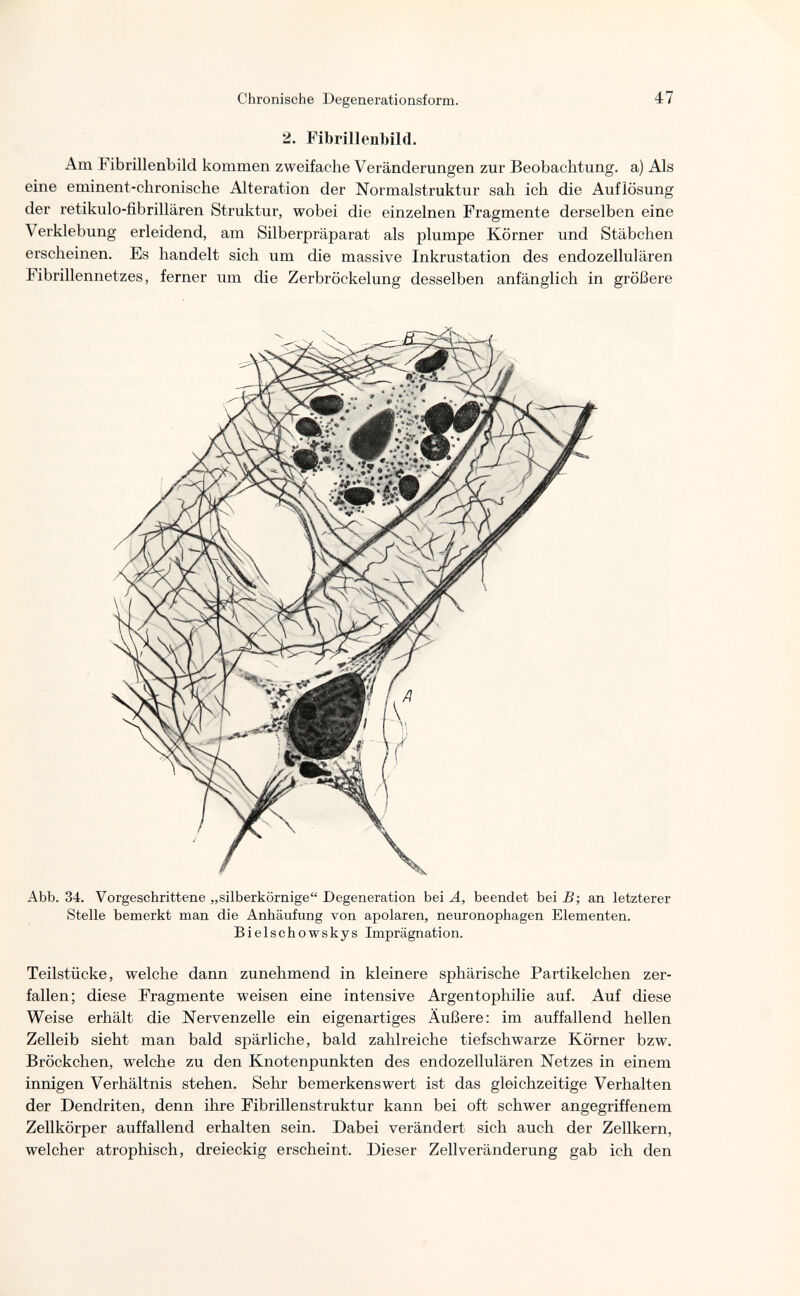 Chronische Degenerationsform. 47 2. Fibrillenbild. Am Fibrillenbild kommen zweifache Veränderungen zur Beobachtung, a) Als eine eminent-chronische Alteration der Normalstruktur sah ich die Auflösung der retikulo-fibrillären Struktur, wobei die einzelnen Fragmente derselben eine Verklebung erleidend, am Silberpräparat als plumpe Körner und Stäbchen erscheinen. Es handelt sich um die massive Inkrustation des endozellulären Fibrillennetzes, ferner um die Zerbröckelung desselben anfänglich in größere Abb. 34. Vorgeschrittene „silberkörnige Degeneration bei A, beendet bei B; an letzterer Stelle bemerkt man die Anhäufung von apolaren, neuronophagen Elementen. Bielschowskys Imprägnation. Teilstücke, welche dann zunehmend in kleinere sphärische Partikelchen zer¬ fallen; diese Fragmente weisen eine intensive Argentophilie auf. Auf diese Weise erhält die Nervenzelle ein eigenartiges Äußere: im auffallend hellen Zelleib sieht man bald spärliche, bald zahlreiche tiefschwarze Körner bzw. Bröckchen, welche zu den Knotenpunkten des endozellulären Netzes in einem innigen Verhältnis stehen. Sehr bemerkenswert ist das gleichzeitige Verhalten der Dendriten, denn ihre Fibrillenstruktur kann bei oft schwer angegriffenem Zellkörper auffallend erhalten sein. Dabei verändert sich auch der Zellkern, welcher atrophisch, dreieckig erscheint. Dieser Zell Veränderung gab ich den