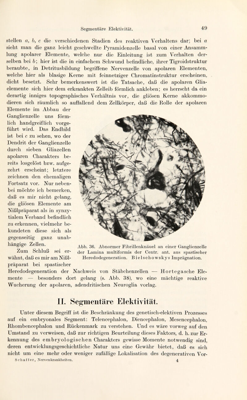 Segmentare Elektivität. 49 stellen a, Ъ, с die verschiedenen Stadien des reaktiven Verhaltens dar; bei a sieht man die ganz leicht geschwellte Pyramidenzelle basal von einer Ansamm¬ lung apolarer Elemente, welche nur die Einleitung ist zum Verhalten der¬ selben bei Ъ ; hier ist die in einfachem Schwund befindliche, ihrer Tigroidstruktur beraubte, in Detritusbildung begriffene Nervenzelle von apolaren Elementen, welche hier als blasige Kerne mit feinnetziger Chromatinstruktur erscheinen, dicht besetzt. Sehr bemerkenswert ist die Tatsache, daß die apolaren Glia- elemente sich hier dem erkrankten Zelleib förmlich ankleben; es herrscht da ein derartig inniges topographisches Verhältnis vor, die gliösen Kerne akkommo- dieren sich räumlich so auffallend dem Zellkörper, daß die Rolle der apolaren Elemente im Abbau der Ganglienzelle uns förm¬ lich handgreiflich vorge¬ führt wird. Das Endbild ist bei с zu sehen, wo der Dendrit der Ganglienzelle durch sieben Gliazellen apolaren Charakters be¬ reits losgelöst bzw. aufge¬ zehrt erscheint; letztere zeichnen den ehemaligen Fortsatz vor. Nur neben¬ bei möchte ich bemerken, daß es mir nicht gelang, die gliösen Elemente am Nißlpräparat als in synzy- tialem Verband befindlich zu erkennen, vielmehr be¬ kundeten diese sich als gegenseitig ganz unab¬ hängige Zellen. Zum Schluß sei er¬ wähnt, daß es mir am Nißl- präparat bei spastischer Heredodegeneration der Nachweis von Stäbchenzellen — Hör tega sehe Ele¬ mente — besonders dort gelang (s. Abb. 38), wo eine mächtige reaktive Wucherung der apolaren, adendritischen Neuroglia vorlag. Abb. 36. Abnormer Fibrillenknäuel an einer Ganglienzelle der Lamina multiformis der Centr. ant. aus spastischer Heredodegeneration. Bielschowskys Imprägnation. II. Segmentare Elektivität. Unter diesem Begriff ist die Beschränkung des genetisch-elektiven Prozesses auf ein embryonales Segment: Telencephalon, Diencephalon, Mesencephalon, Rhombencephalon und Rückenmark zu verstehen. Und es wäre vorweg auf den Umstand zu verweisen, daß zur richtigen Beurteilung dieses Faktors, d. h. zur Er¬ kennung des embryologischen Charakters gewisse Momente notwendig sind, deren entwicklungsgeschichtliche Natur uns eine Gewähr bietet, daß es sich nicht um eine mehr oder weniger zufällige Lokalisation des degenerativen Vor- Schaffer, Nervenkrankheiten. 4