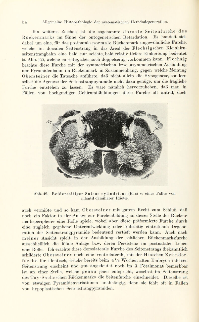 54 Allgemeine Histopathologie der systematischen Heredodegeneration. Ein weiteres Zeichen ist die sogenannte dorsale Seitenfurche des Rückenmarks im Sinne der ontogenetischen Retardation. Es handelt sich dabei um eine, für das postnatale normale Rückenmark ungewöhnliche Furche, welche im dorsalen Seitenstrang in das Areal der Flechsigschen Kleinhirn- seitenstrangbahn eine bald nur seichte, bald relativ tiefere Einkerbung bedeutet (s. Abb. 42), welche einseitig, aber auch doppelseitig vorkommen kann. Flechsig brachte diese Furche mit der symmetrischen bzw. asymmetrischen Ausbildung der Pyramidenbahn im Rückenmark in Zusammenhang, gegen welche Meinung Obersteiner die Tatsache anführte, daß nicht allein die Hypogenese, sondern selbst die Agenese der Seitenstrangpyramide nicht dazu genüge, um die fragliche Furche entstehen zu lassen. Es wäre nämlich hervorzuheben, daß man in Fällen von hochgradigen Gehirnmißbildungen diese Furche oft antraf, doch Abb. 42. Beiderseitiger Sulcus cylindricus (His) sc eines Falles von infantil - familiärer Idiotie. auch vermißte und so kam Obersteiner mit gutem Recht zum Schluß, daß noch ein Faktor in der Anlage zur Furchenbildung an dieser Stelle der Rücken¬ marksperipherie eine Rolle spiele, wobei aber diese präformierte Furche durch eine zugleich gegebene Unterentwicklung oder frühzeitig eintretende Degene¬ ration der Seitenstrangpyramide bedeutend vertieft werden kann. Auch nach meiner Ansicht spielt in der Ausbildung der seitlichen Rückenmarksfurche ausschließlich die fötale Anlage bzw. deren Persistenz im postnatalen Leben eine Rolle. Ich erachte diese dorsolaterale Furche des Seitenstrangs (bekanntlich schilderte Obersteiner noch eine ventrolaterale) mit der H is sehen Zylinder¬ furche für identisch, welche bereits beim 4V2 Wochen alten Embryo in dessen Seitenstrang erscheint und gut angedeutet noch im 3. Fötalmonat bemerkbar ist an einer Stelle, welche genau jener entspricht, woselbst im Seitenstrang des Tay-Sachsschen Rückenmarks die Seitenfurche einschneidet. Dieselbe ist von etwaigen Pyramidenvariationen unabhängig, denn sie fehlt oft in Fällen von hypoplastischen Seitenstrangpyramiden.