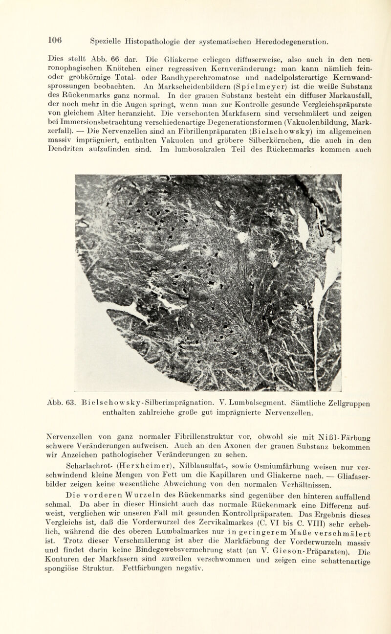 106 Spezielle Histopathologic der systematischen Heredodegeneration. Dies stellt Abb. 66 dar. Die Gliakerne erliegen diffuserweise, also auch in den neu- ronophagischen Knötchen einer regressiven Kernveränderung: man kann nämlich fein- oder grobkörnige Total- oder Randhyperchromatose und nadelpolsterartige Kernwand- sprossungen beobachten. An Markscheidenbildern (Spielmeyer) ist die weiße Substanz des Rückenmarks ganz normal. In der grauen Substanz besteht ein diffuser Markausfall, der noch mehr in die Augen springt, wenn man zur Kontrolle gesunde Vergleichspräparate von gleichem Alter heranzieht. Die verschonten Markfasern sind verschmälert und zeigen bei Immersionsbetrachtung verschiedenartige Degenerationsformen (Vakuolenbildung, Mark¬ zerfall). — Die Nervenzellen sind an FibriUenpräparaten (ßielschowsky) im allgemeinen massiv imprägniert, enthalten Vakuolen und gröbere Silberkörnchen, die auch in den Dendriten aufzufinden sind. Im lumbosakralen Teil des Rückenmarks kommen auch Abb. 63. Bielschowsky-Silberimprägnation. V. Lumbaisegment. Sämtliche Zellgruppen enthalten zahlreiche große gut imprägnierte Nervenzellen. Nervenzellen von ganz normaler Fibrillenstruktur vor, obwohl sie mit Nißl-Färbung schwere Veränderungen aufweisen. Auch an den Axonen der grauen Substanz bekommen wir Anzeichen pathologischer Veränderungen zu sehen. Scharlachrot- (Herxheimer), Nilblausulfat-, sowie Osmiumfärbung weisen nur ver¬ schwindend kleine Mengen von Fett um die Kapillaren und Gliakerne nach. — Gliafaser- bilder zeigen keine wesentliche Abweichung von den normalen Verhältnissen. Die vorderen Wurzeln des Rückenmarks sind gegenüber den hinteren auffallend schmal. Da aber in dieser Hinsicht auch das normale Rückenmark eine Differenz auf¬ weist, verglichen wir unseren Fall mit gesunden Kontrollpräparaten. Das Ergebnis dieses Vergleichs ist, daß die Vorderwurzel des Zervikalmarkes (C. VI bis C. VIII) sehr erheb¬ lich, während die des oberen Lumbalmarkes nur in geringerem Maße verschmälert ist. Trotz dieser Verschmälerung ist aber die Markfärbung der Vorderwurzeln massiv und findet darin keine Bindegewebsvermehrung statt (an V. Gieson-Präparaten), Die Konturen der Markfasern sind zuweilen verschwommen und zeigen eine schattenartige spongiöse Struktur. Fettfärbungen negativ.