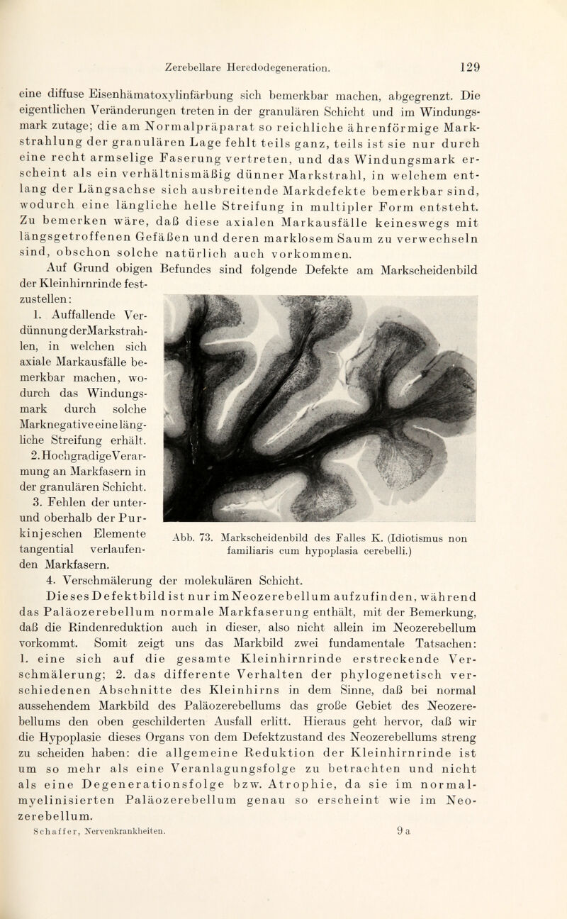 Zerebellare Heredodegeneration. 129 eine diffuse Eisenhämatoxylinfärbung sich bemerkbar raachen, abgegrenzt. Die eigentlichen Veränderungen treten in der granulären Schicht und im Windungs¬ mark zutage; die am Normalpräparat so reichliche ährenförmige Mark¬ strahlung der granulären Lage fehlt teils ganz, teils ist sie nur durch eine recht armselige Faserung vertreten, und das Windungsmark er¬ scheint als ein verhältnismäßig dünner Markstrahl, in welchem ent¬ lang der Längsachse sich ausbreitende Markdefekte bemerkbar sind, wodurch eine längliche helle Streifung in multipler Form entsteht. Zu bemerken wäre, daß diese axialen Markausfälle keineswegs mit längsgetroffenen Gefäßen und deren marklosem Saum zu verwechseln sind, obschon solche natürlich auch vorkommen. Auf Grund obigen Befundes sind folgende Defekte am Markscheidenbild der Kleinhirnrinde fest¬ zustellen : 1. Auffallende Ver¬ dünnung derMarkstrah- len, in welchen sich axiale Markausfälle be¬ merkbar machen, wo¬ durch das Windungs¬ mark durch solche Marknegative eine läng¬ liche Streifung erhält. 2. Hochgradige V erar- mung an Markfasern in der granulären Schicht. 3. Fehlen der unter- und oberhalb derPur- kinj eschen Elemente tangential verlaufen¬ den Markfasern. 4. Verschmälerung der molekulären Schicht. Die ses Defektbild ist nur imNeozerebellum aufzufinden, während das Paläozerebellum normale Markfaserung enthält, mit der Bemerkung, daß die Rindenreduktion auch in dieser, also nicht allein im Neozerebellum vorkommt. Somit zeigt uns das Markbild zwei fundamentale Tatsachen: 1. eine sich auf die gesamte Kleinhirnrinde erstreckende Ver- schmälerung; 2. das differente Verhalten der phylogenetisch ver¬ schiedenen Abschnitte des Kleinhirns in dem Sinne, daß bei normal aussehendem Markbild des Paläozerebellums das große Gebiet des Neozere- bellums den oben geschilderten Ausfall erlitt. Hieraus geht hervor, daß wir die Hypoplasie dieses Organs von dem Defektzustand des Neozerebellums streng zu scheiden haben: die allgemeine Reduktion der Kleinhirnrinde ist um so mehr als eine Veranlagungsfolge zu betrachten und nicht als eine Degenerationsfolge bzw. Atrophie, da sie im normal- myelinisierten Paläozerebellum genau so erscheint wie im Neo¬ zerebellum. Schaffer, Nervenkrankheiten. 9 a Abb. 73. Markscheidenbild des Falles K. (Idiotismus non familiaris cum hypoplasia cerebelli.)