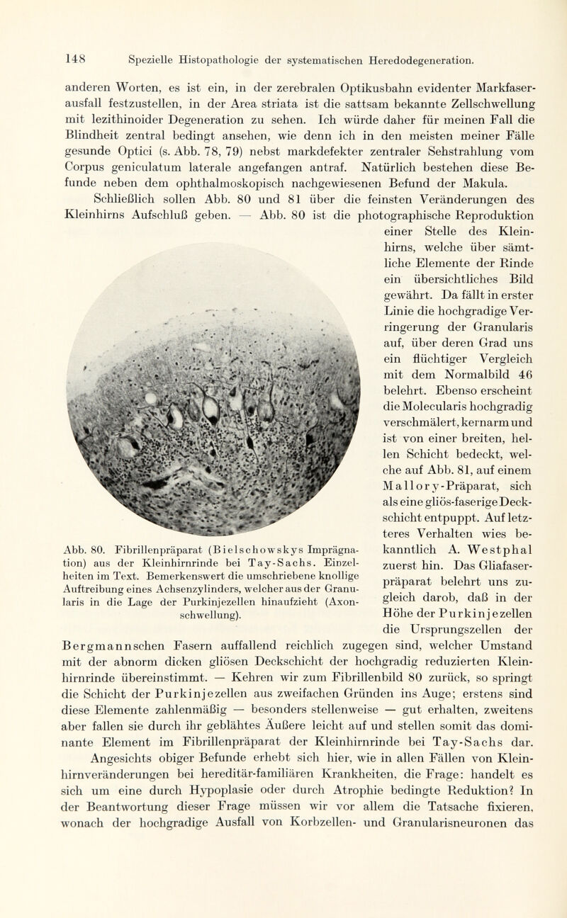 148 Spezielle Histopathologic der systematischen Heredodegeneration. anderen Worten, es ist ein, in der zerebralen Optikusbahn evidenter Markfaser¬ ausfall festzustellen, in der Area striata ist die sattsam bekannte Zellschwellung mit lezithinoider Degeneration zu sehen. Ich würde daher für meinen Fall die Blindheit zentral bedingt ansehen, wie denn ich in den meisten meiner Fälle gesunde Optici (s. Abb. 78, 79) nebst markdefekter zentraler Sehstrahlung vom Corpus geniculatum laterale angefangen antraf. Natürlich bestehen diese Be¬ funde neben dem ophthalmoskopisch nachgewiesenen Befund der Makula. Schließlich sollen Abb. 80 und 81 über die feinsten Veränderungen des Kleinhirns Aufschluß geben. — Abb. 80 ist die photographische Reproduktion einer Stelle des Klein¬ hirns, welche über sämt¬ liche Elemente der Rinde ein übersichtliches Bild gewährt. Da fällt in erster Linie die hochgradige Ver¬ ringerung der Granularis auf, über deren Grad uns ein flüchtiger Vergleich mit dem Normalbild 46 belehrt. Ebenso erscheint die Molecularis hochgradig verschmälert, kernarm und ist von einer breiten, hel¬ len Schicht bedeckt, wel¬ che auf Abb. 81, auf einem Mallory-Präparat, sich als eine gliös-faserigeDeck¬ schicht entpuppt. Auf letz¬ teres Verhalten wies be¬ kanntlich A. Westphal zuerst hin. Das Gliafaser- präparat belehrt uns zu¬ gleich darob, daß in der Höhe der Purkinjezellen die Ursprungszellen der В ergmann sehen Fasern auffallend reichlich zugegen sind, welcher Umstand mit der abnorm dicken gliösen Deckschicht der hochgradig reduzierten Klein¬ hirnrinde übereinstimmt. — Kehren wir zum Fibrillenbild 80 zurück, so springt die Schicht der Purkinjezellen aus zweifachen Gründen ins Auge; erstens sind diese Elemente zahlenmäßig — besonders stellenweise — gut erhalten, zweitens aber fallen sie durch ihr geblähtes Äußere leicht auf und stellen somit das domi¬ nante Element im Fibrillenpräparat der Kleinhirnrinde bei Tay-Sachs dar. Angesichts obiger Befunde erhebt sich hier, wie in allen Fällen von Klein¬ hirnveränderungen bei hereditär-familiären Krankheiten, die Frage: handelt es sich um eine durch Hypoplasie oder durch Atrophie bedingte Reduktion? In der Beantwortung dieser Frage müssen wir vor allem die Tatsache fixieren, wonach der hochgradige Ausfall von Korbzellen- und Granularisneuronen das Abb. 80. Fibrillenpräparat (Bielschowskys Imprägna¬ tion) aus der Kleinhirnrinde bei Tay-Sachs. Einzel¬ heiten im Text. Bemerkenswert die umschriebene knollige Auftreibung eines Achsenzylinders, welcher aus der Granu¬ laris in die Lage der Purkinjezellen hinaufzieht (Axon- schwellung).