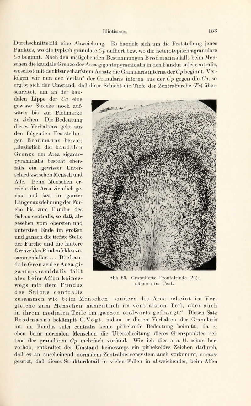 Idiotismus. 153 Durchschnittsbild eine Abweichung. Es handelt sich um die Feststellung jenes Punktes, wo die typisch granuläre Cp aufhört bzw. wo die heterotypisch-agranuläre Ca beginnt. Nach den maßgebenden Bestimmungen Brodmanns fällt beim Men¬ schen die kaudale Grenze der Area gigantopyramidalis in den Fundus sulci centralis, woselbst mit denkbar schärfstem Ansatz die Granularis interna der Cp beginnt. Ver¬ folgen wir nun den Verlauf der Granularis interna aus der Cp gegen die Ca, so ergibt sich der Umstand, daß diese Schicht die Tiefe der Zentralfurche {Fe) über¬ schreitet, um an der kau- dalen Lippe der Ca eine gewisse Strecke noch auf¬ wärts bis zur Pfeilmarke zu ziehen. Die Bedeutung dieses Verhaltens geht aus den folgenden Feststellun¬ gen Brodmanns hervor: „Bezüglich der kaudalen Grenze der Area giganto¬ pyramidalis besteht eben¬ falls ein gewisser Unter¬ schied zwischen Mensch und Affe. Beim Menschen er¬ reicht die Area ziemlich ge¬ nau und fast in ganzer Längenausdehnung der Fur¬ che bis zum Fundus des Sulcus centralis, so daß, ab¬ gesehen vom obersten und untersten Ende im großen und ganzen die tiefste Stelle der Furche und die hintere Grenze des Rindenfeldes zu¬ sammenfallen ... Di e kau- daleGrenzeder Area gi¬ gantopyramidalis fällt also beim Affen keines¬ wegs mit dem Fundus des Sulcus centralis zusammen wie beim Menschen, sondern die Area scheint im Ver¬ gleiche zum Menschen namentlich im ventralsten Teil, aber auch in ihrem medialen Teile im ganzen oralwärts gedrängt. Diesen Satz Brodmanns bekämpft O.Vogt, indem er diesem Verhalten der Granularis int. im Fundus sulci centralis keine pithekoide Bedeutung beimißt, da er eben beim normalen Menschen die Überschreitung dieses Grenzpunktes sei¬ tens der granulären Cp mehrfach vorfand. Wie ich dies a. a. 0. schon her¬ vorhob, entkräftet der Umstand keineswegs ein pithekoides Zeichen dadurch, daß es an anscheinend normalem Zentralnervensystem auch vorkommt, voraus¬ gesetzt, daß dieses Strukturdetail in vielen Fällen in abweichender, beim Affen Abb. 85. Granulierte Frontalrinde ; näheres im Text.