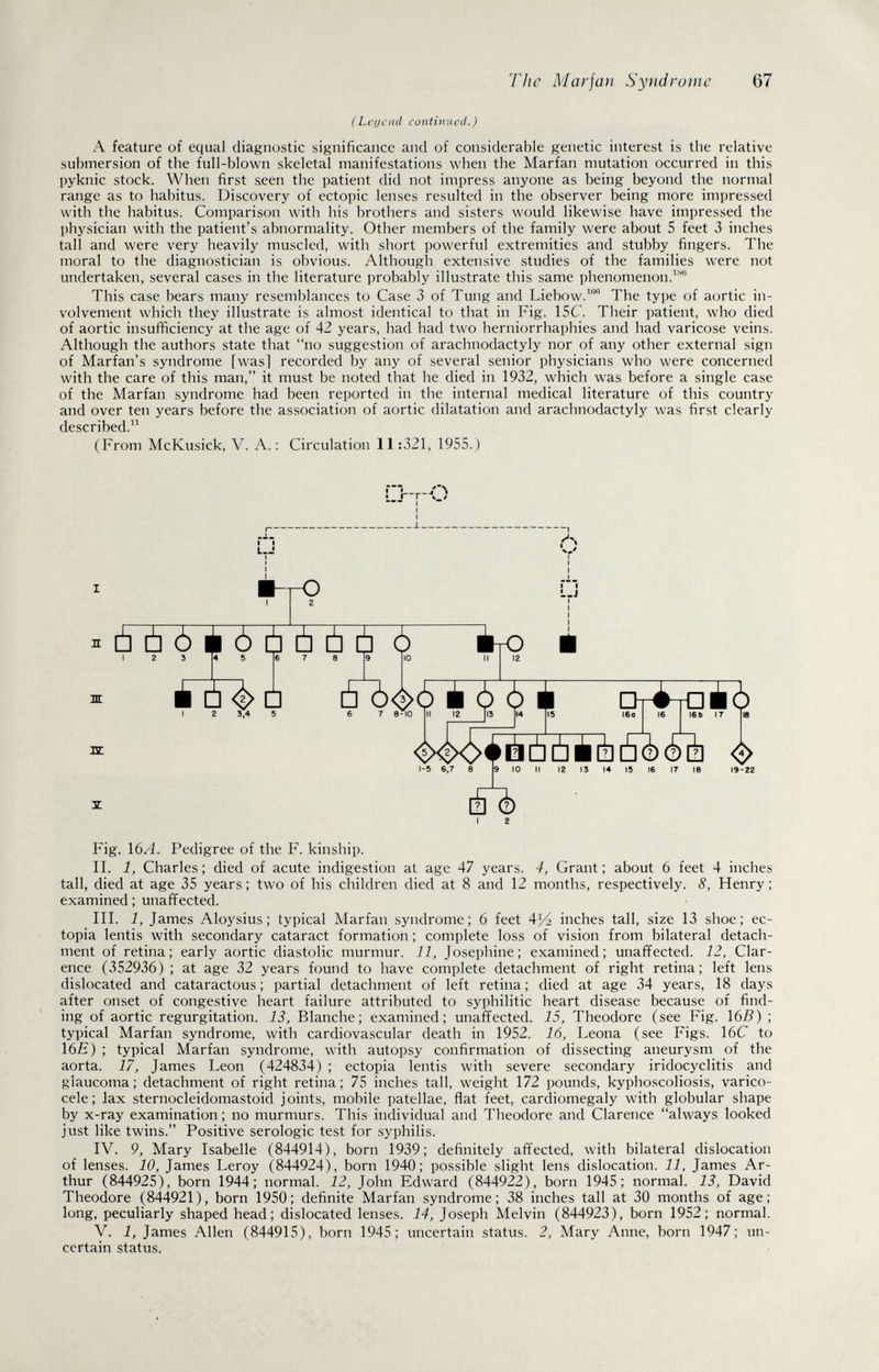 Tìic Marian Syndrome 67 (Lcç/cnil continued.) A feature of equal diagnostic significance and of considerable genetic interest is the relative submersion of the full-blown skeletal manifestations when the Marfan mutation occurred in this pyknic stock. When first seen the patient did not impress anyone as being beyond the normal range as to habitus. Discovery of ectopic lenses resulted in the observer being more impressed with the habitus. Comparison with his brothers and sisters would likewise have impressed the physician with the patient's abnormality. Other members of the family were about 5 feet 3 inches tall and were very heavily muscled, with short powerful extremities and stubby fingers. The moral to the diagnostician is obvious. Although extensive studies of the families were not undertaken, several cases in the literature probably illustrate this same phenomenon.^'''' This case bears many resemblances to Case 3 of Tung and Liebow.^*' The type of aortic in¬ volvement which they illustrate is almost identical to that in Fig. 15C. Their patient, who died of aortic insufficiency at the age of 42 years, had had two herniorrhaphies and had varicose veins. Although the authors state that no suggestion of arachnodactyly nor of any other external sign of Marfan's syndrome [was] recorded by any of several senior physicians who were concerned with the care of this man, it must be noted that he died in 1932, which was before a single case of the Marfan syndrome had been reported in the internal medical literature of this country and over ten years before the association of aortic dilatation and arachnodactyly was first clearly described.'^ (From McKusick, V. A. : Circulation 11:321, 1955.) Fig. \6A. Pedigree of the F. kinship. II. 1, Charles ; died of acute indigestion at age 47 years. 4, Grant ; about 6 feet 4 inches tall, died at age 35 years ; two of his children died at 8 and 12 months, respectively. 8, Henry ; examined; unaffected. III. 1, James Aloysius; typical Marfan syndrome; 6 feet 4^ inches tall, size 13 shoe; ec¬ topia lentis with secondary cataract formation ; complete loss of vision from bilateral detach¬ ment of retina; early aortic diastolic murmur. 11, Josephine; examined; unaffected. 12, Clar¬ ence (352936) ; at age 32 years found to have complete detachment of right retina; left lens dislocated and cataractous ; partial detachment of left retina ; died at age 34 years, 18 days after onset of congestive heart failure attributed to syphilitic heart disease because of find¬ ing of aortic regurgitation. 13, Blanche; examined; unaffected. 15, Theodore (see Fig. 165) ; typical Marfan syndrome, with cardiovascular death in 1952. 16, Leona (see Figs. 16C to 16£) ; typical Marfan syndrome, with autopsy confirmation of dissecting aneurysm of the aorta. 17, James Leon (424834) ; ectopia lentis with severe secondary iridocyclitis and glaucoma; detachment of right retina; 75 inches tall, weight 172 pounds, kyphoscoliosis, varico¬ cele; lax sternocleidomastoid joints, mobile patellae, flat feet, cardiomegaly with globular shape by x-ray examination ; no murmurs. This individual and Theodore and Clarence always looked just like twins. Positive serologic test for syphilis. IV. 9, Mary Isabelle (844914), born 1939; definitely affected, with bilateral dislocation of lenses. 10, James Leroy (844924), born 194Ò; possible slight lens dislocation. 11, James Ar¬ thur (844925), born 1944; normal. 12, John Edward (844922), born 1945; normal. 13, David Theodore (844921), born 1950; definite Marfan syndrome; 38 inches tall at 30 months of age; long, peculiarly shaped head; dislocated lenses. 14, Joseph Mel vin (844923), born 1952; normal. V. 1, James Allen (844915), born 1945; uncertain status. 2, Mary Anne, born 1947; un¬ certain status.