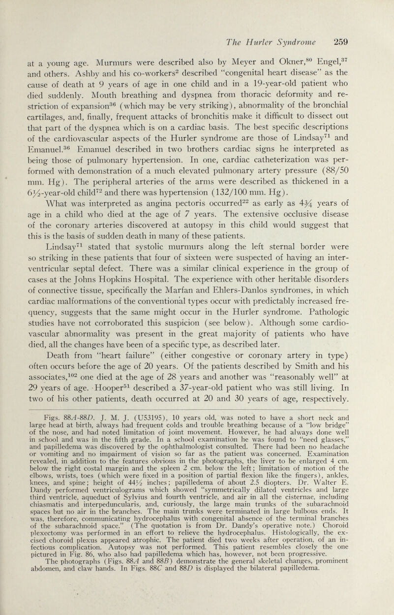 The Hurler Syndrome 259 at a young age. Murmurs were described also by Meyer and Okner,^« Engel, and others. Ashby and his co-workers^ described congenital heart disease as the cause of death at 9 years of age in one child and in a 19-year-old patient who died suddenly. Mouth breathing and dyspnea from thoracic deformity and re¬ striction of expansion^*^ (which may be very striking), abnormality of the bronchial cartilages, and, finally, frequent attacks of bronchitis make it difficult to dissect out that part of the dyspnea which is on a cardiac basis. The best specific descriptions of the cardiovascular aspects of the Hurler syndrome are those of Lindsay^^ and Emanuel.^® Emanuel described in two brothers cardiac signs he interpreted as being those of pulmonary hypertension. In one, cardiac catheterization was per¬ formed with demonstration of a much elevated pulmonary artery pressure (88/50 mm. Hg). The peripheral arteries of the arms were described as thickened in a 6j^-year-old child^^ and there was hypertension (132/100 mm. Hg). What was interpreted as angina pectoris occurred^^ as early as 4^ years of age in a child who died at the age of 7 years. The extensive occlusive disease of the coronary arteries discovered at autopsy in this child would suggest that this is the basis of sudden death in many of these patients. Lindsay'^ stated that systolic murmurs along the left sternal border were so striking in these patients that four of sixteen were suspected of having an inter¬ ventricular septal defect. There was a similar clinical experience in the group of cases at the Johns Hopkins Hospital. The experience with other heritable disorders of connective tissue, specifically the Marfan and Ehlers-Danlos syndromes, in which cardiac malformations of the conventional types occur with predictably increased fre¬ quency, suggests that the same might occur in the Hurler syndrome. Pathologic studies have not corroborated this suspicion (see below). Although some cardio¬ vascular abnormality was present in the great majority of patients who have died, all the changes have been of a specific type, as described later. Death from heart failure (either congestive or coronary artery in type) often occurs before the age of 20 years. Of the patients described by Smith and his associates,^®^ one died at the age of 28 years and another was reasonably well at 29 years of age. -Hooper^^ described a 37-year-old patient who was still living. In two of his other patients, death occurred at 20 and 30 years of age, respectively. Figs. 88A-88D. J. M. J. (U53195), 10 years old, was noted to have a short neck and large head at birth, always had frequent colds and trouble breathing because of a low bridge of the nose, and had noted limitation of joint movement. However, he had always done well in school and was in the fifth grade. In a school examination he was found to need glasses, and papilledema was discovered by the ophthalmologist consulted. There had been no headache or vomiting and no impairment of vision so far as the patient was concerned. Examination revealed, in addition to the features obvious in the photographs, the liver to be enlarged 4 cm. below the right costal margin and the spleen 2 cm. below the left ; limitation of motion of the elbows, wrists, toes (which were fixed in a position of partial flexion like the fingers), ankles, knees, and spine; height of 44^ inches; papilledema of about 2.5 diopters. Dr. Walter E. Dandy performed ventriculograms which showed symmetrically dilated ventricles and large third ventricle, aqueduct of Sylvius and fourth ventricle, and air in all the cisternae, including chiasmatis and interpeduncularis, and, curiously, the large main trunks of the subarachnoid spaces but no air in the branches. The main trunks were terminated in large bulbous ends. It was, therefore, communicating hydrocephalus with congenital absence of the terminal branches of the subarachnoid space. (The quotation is from Dr. Dandy's operative note.) Choroid plexectomy was performed in an effort to relieve the hydrocephalus. Histologically, the ex¬ cised choroid plexus appeared atrophic. The patient died two weeks after operation, of an in¬ fectious complication. Autopsy was not performed. This patient resembles closely the one pictured in Fig. 86, who also had papilledema which has, however, not been progressive. The photographs (Figs. 88A and 88ß) demonstrate the general skeletal changes, prominent abdomen, and claw hands. In Figs. 88C and 88D is displayed the bilateral papilledema.