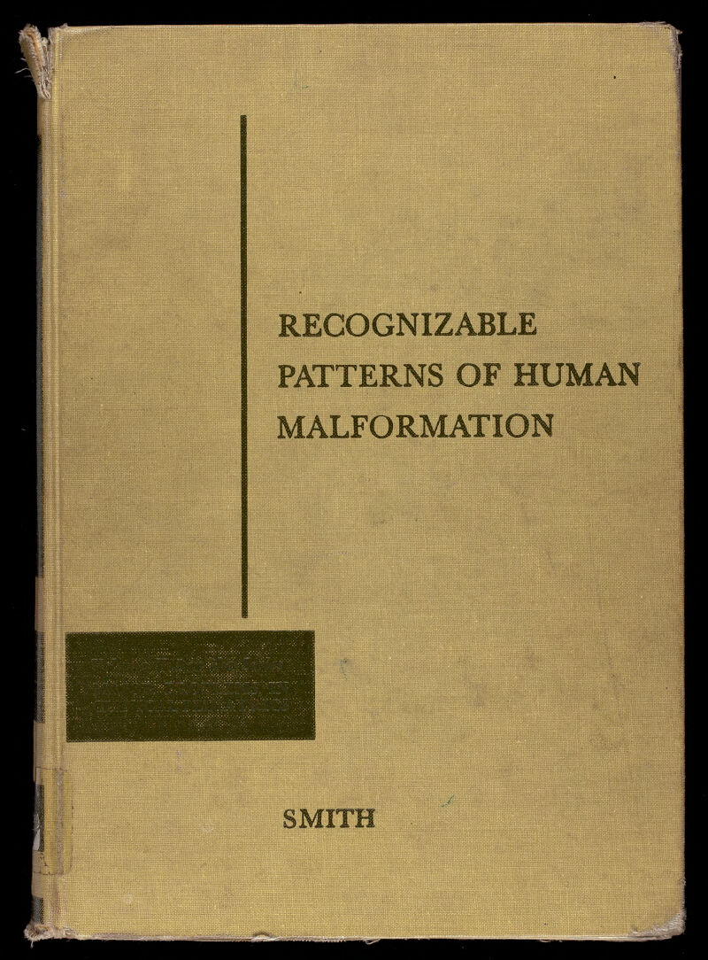 fi' í ииши 'lllilil ршшр щш L.fi$>;r ~ -í-f ■il mi |Й|||Ш|11| RECOGNIZABLE PATTERNS OF HUMAN MALFORMATION mm SMITH