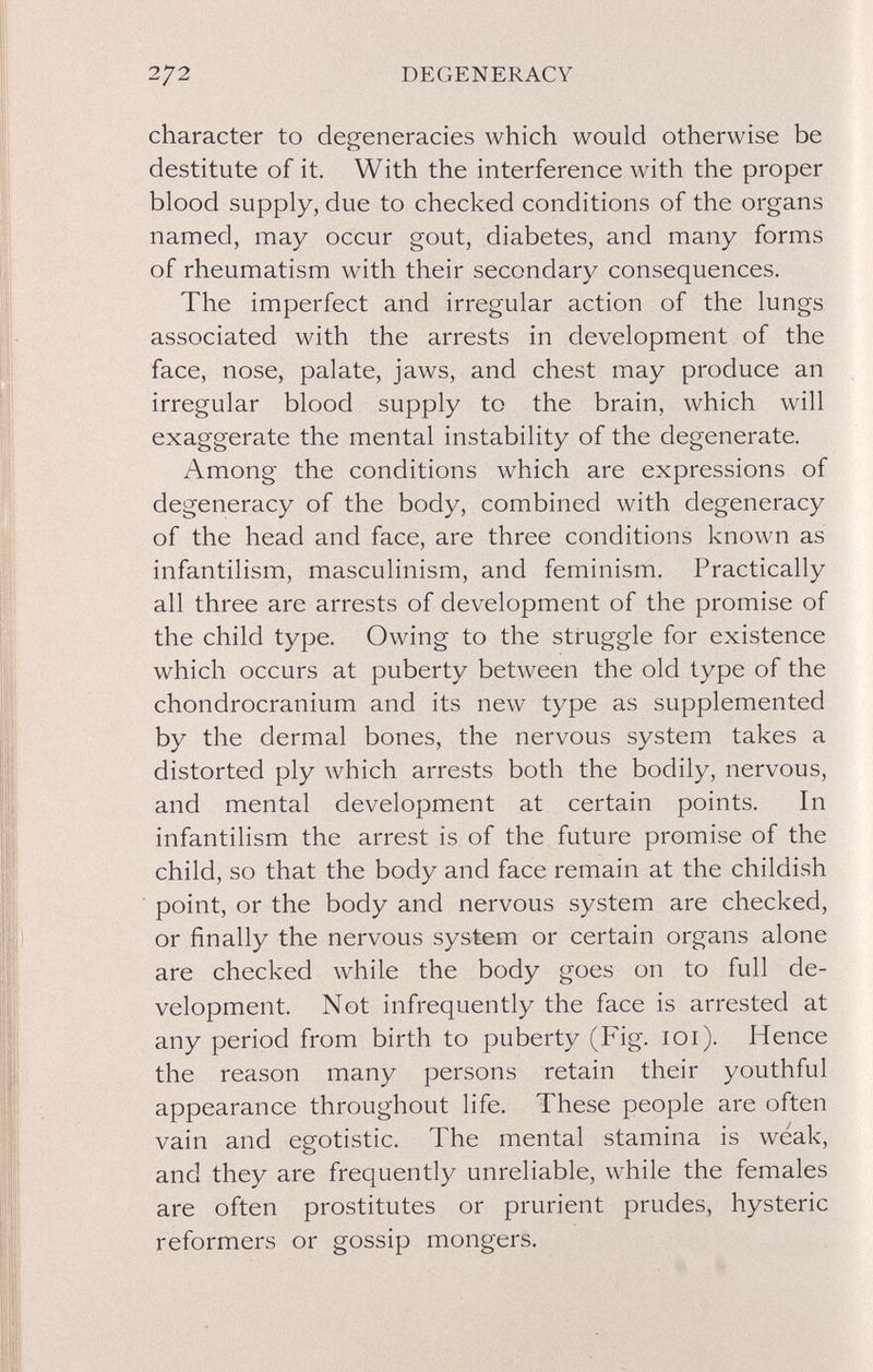 272 DEGENERACY character to degeneracies which would otherwise be destitute of it. With the interference with the proper blood supply, due to checked conditions of the organs named, may occur gout, diabetes, and many forms of rheumatism with their secondary consequences. The imperfect and irregular action of the lungs associated with the arrests in development of the face, nose, palate, jaws, and chest may produce an irregular blood supply to the brain, which will exaggerate the mental instability of the degenerate. Among the conditions which are expressions of degeneracy of the body, combined with degeneracy of the head and face, are three conditions known as infantilism, masculinism, and feminism. Practically all three are arrests of development of the promise of the child type. Owing to the struggle for existence which occurs at puberty between the old type of the chondrocranium and its new type as supplemented by the dermal bones, the nervous system takes a distorted ply which arrests both the bodily, nervous, and mental development at certain points. In infantilism the arrest is of the future promise of the child, so that the body and face remain at the childish point, or the body and nervous system are checked, or finally the nervous system or certain organs alone are checked while the body goes on to full de¬ velopment. Not infrequently the face is arrested at any period from birth to puberty (Fig. lOi). Hence the reason many persons retain their youthful appearance throughout life. These people are often vain and egotistic. The mental stamina is weak, and they are frequently unreliable, while the females are often prostitutes or prurient prudes, hysteric reformers or gossip mongers.