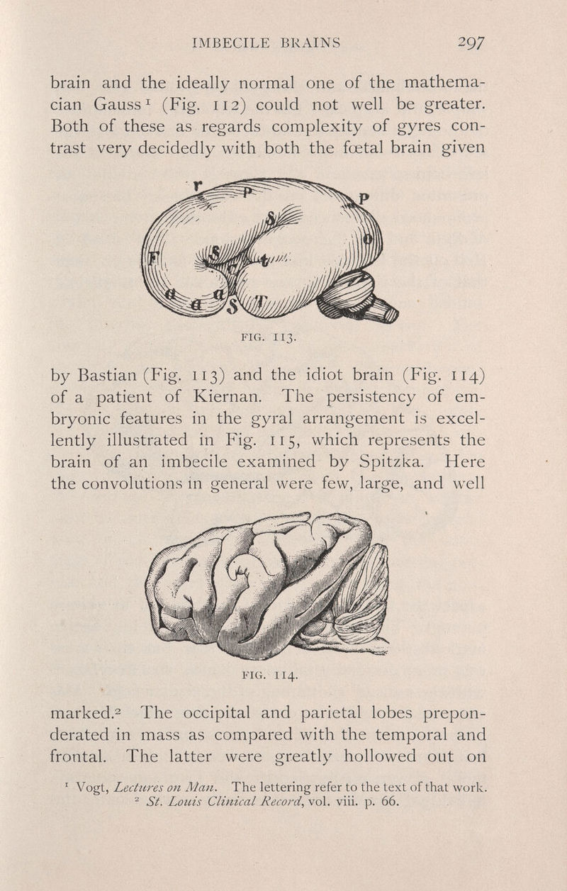 IMBECILE BRAINS 297 brain and the ideally normal one of the mathema- cian Gauss ^ (Fig. 112) could not well be greater. Both of these as regards complexity of gyres con¬ trast very decidedly with both the foetal brain given by Bastian (Fig. 113) and the idiot brain (Fig. 114) of a patient of Kiernan. The persistency of em¬ bryonic features in the gyral arrangement is excel¬ lently illustrated in Fig. 115, which represents the brain of an imbecile examined by Spitzka. Here the convolutions m general were few, large, and well FIG. 114. marked.2 The occipital and parietal lobes prepon¬ derated in mass as compared with the temporal and frontal. The latter were greatly hollowed out on ' Vogt, Lechires on Man. The lettering refer to the text of that work. ^ St. Louis Clinical Record, ^o\. viii. p. 66.