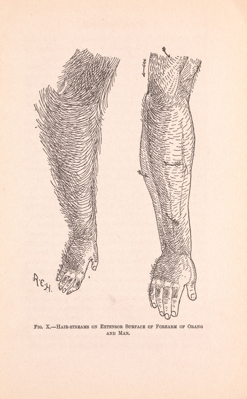 Fig. X.—Haih-steeams on Extensor Surface of Fobeabm op Oeanq and Man.