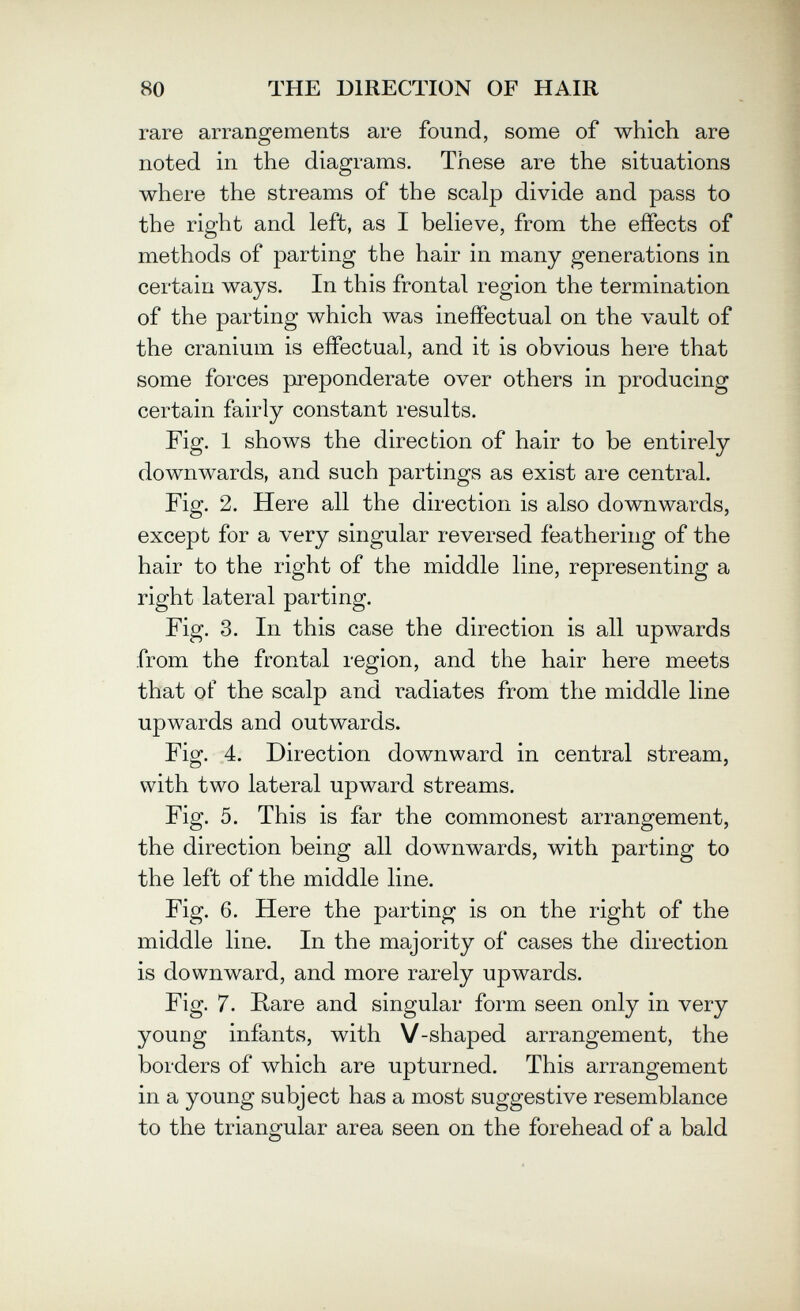 80 THE DIRECTION OF HAIR rare arrangements are found, some of which are noted in the diagrams. These are the situations where the streams of the scalp divide and pass to the right and left, as I believe, from the effects of methods of parting the hair in many generations in certain ways. In this frontal region the termination of the parting which was ineffectual on the vault of the cranium is effectual, and it is obvious here that some forces preponderate over others in producing certain fairly constant results. Fig. 1 shows the direction of hair to be entirely downwards, and such partings as exist are central. Fig. 2. Here all the direction is also downwards, except for a very singular reversed feathering of the hair to the right of the middle line, representing a right lateral parting. Fig. 3. In this case the direction is all upwards from the frontal region, and the hair here meets that of the scalp and radiates from the middle line upwards and outwards. Fig. 4. Direction downward in central stream, with two lateral upward streams. Fig. 5. This is far the commonest arrangement, the direction being all downwards, with parting to the left of the middle line. Fig. 6. Here the parting is on the right of the middle line. In the majority of cases the direction is downward, and more rarely upwards. Kg. 7. Rare and singular form seen only in very young infants, with V-shaped arrangement, the borders of which are upturned. This arrangement in a young subject has a most suggestive resemblance to the triangular area seen on the forehead of a bald