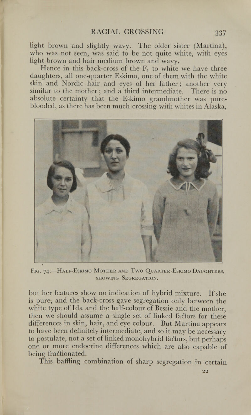 RACIAL GROSSING 337 light brown and slightly wavy. The older sister (Martina), who was not seen, was said to be not quite white, with eyes light brown and hair medium brown and wavy. Hence in this back-cross of the to white we have three daughters, all one-quarter Eskimo, one of them with the white skin and Nordic hair and eyes of her father ; another very similar to the mother ; and a third intermediate. There is no absolute certainty that the Eskimo grandmother was pure- blooded, as there has been much crossing with whites in Alaska, Fig. 74.—Half-Eskimo Mother and Two Quarter-Eskimo Daughters, showing Segregation. but her features show no indication of hybrid mixture. If she is pure, and the back-cross gave segregation only between the white type of Ida and the half-colour of Bessie and the mother, then we should assume a single set of linked fadors for these differences in skin, hair, and eye colour. But Martina appears to have been definitely intermediate, and so it may be necessary to postulate, not a set of linked monohybrid fadors, but perhaps one or more endocrine differences which are also capable of being fradionated. This baffling combination of sharp segregation in certain 22