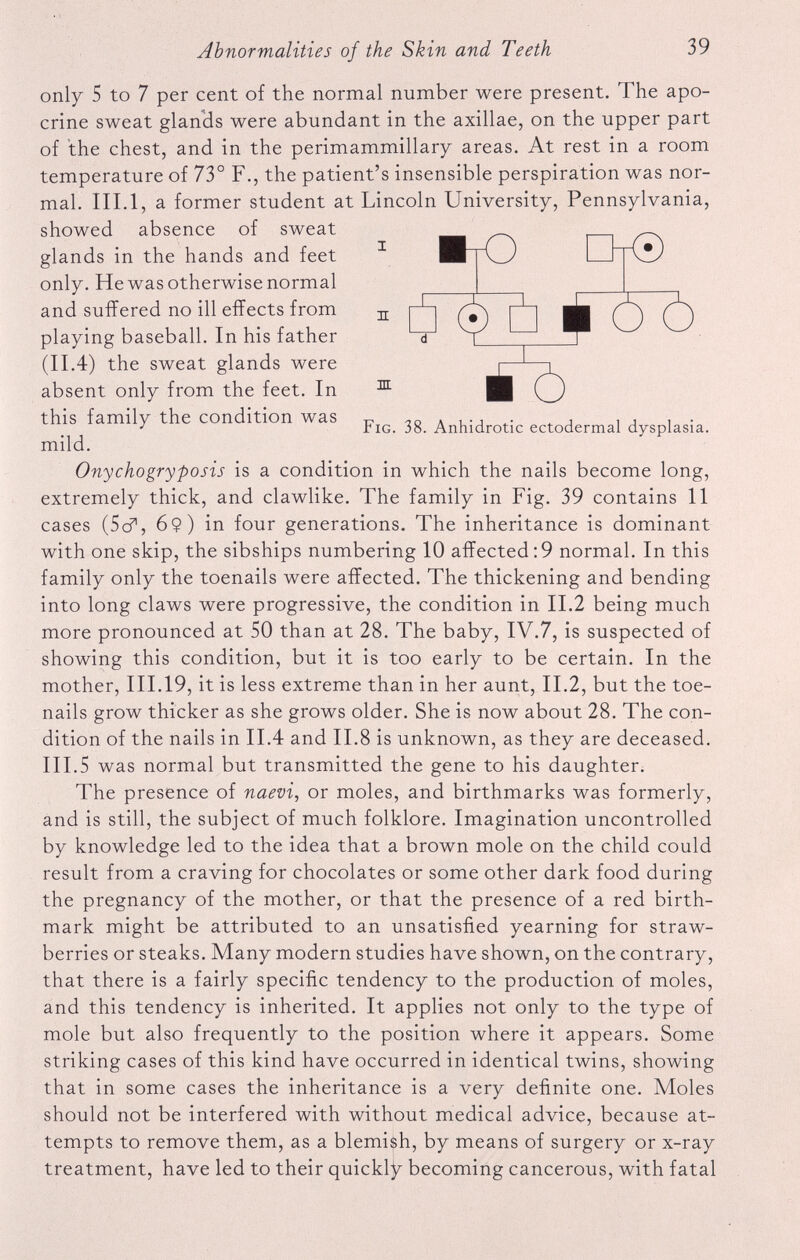 only 5 to 7 per cent of the normal number were present. The apo crine sweat glands were abundant in the axillae, on the upper part of the chest, and in the perimammillary areas. At rest in a room temperature of 73° F., the patient’s insensible perspiration was nor mal. III. 1, a former student at Lincoln University, Pennsylvania, showed absence of sweat glands in the hands and feet only. He was otherwise normal and suffered no ill effects from playing baseball. In his father (II.4) the sweat glands were absent only from the feet. In this family the condition was mild. 31 m Fig. 38. Anhidrotic ectodermal dysplasia. Onychogryposis is a condition in which the nails become long, extremely thick, and clawlike. The family in Fig. 39 contains 11 cases (5cf, 6$) in four generations. The inheritance is dominant with one skip, the sibships numbering 10 affected:9 normal. In this family only the toenails were affected. The thickening and bending into long claws were progressive, the condition in II.2 being much more pronounced at 50 than at 28. The baby, IV.7, is suspected of showing this condition, but it is too early to be certain. In the mother, III.19, it is less extreme than in her aunt, II.2, but the toe nails grow thicker as she grows older. She is now about 28. The con dition of the nails in II.4 and II.8 is unknown, as they are deceased. III.5 was normal but transmitted the gene to his daughter. The presence of naevi , or moles, and birthmarks was formerly, and is still, the subject of much folklore. Imagination uncontrolled by knowledge led to the idea that a brown mole on the child could result from a craving for chocolates or some other dark food during the pregnancy of the mother, or that the presence of a red birth mark might be attributed to an unsatisfied yearning for straw berries or steaks. Many modern studies have shown, on the contrary, that there is a fairly specific tendency to the production of moles, and this tendency is inherited. It applies not only to the type of mole but also frequently to the position where it appears. Some striking cases of this kind have occurred in identical twins, showing that in some cases the inheritance is a very definite one. Moles should not be interfered with without medical advice, because at tempts to remove them, as a blemish, by means of surgery or x-ray treatment, have led to their quickly becoming cancerous, with fatal