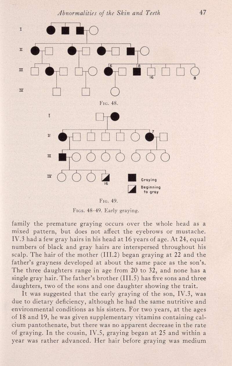 *”i>o E HI 32 IhO DrO it m 12 i 16 o Fig. 48. 16 Graying a Beginning to gray Fig. 49. Figs. 48-49. Early graying. family the premature graying occurs over the whole head as a mixed pattern, but does not affect the eyebrows or mustache. IV.3 had a few gray hairs in his head at 16 years of age. At 24, equal numbers of black and gray hairs are interspersed throughout his scalp. The hair of the mother (III.2) began graying at 22 and the father’s grayness developed at about the same pace as the son’s. The three daughters range in age from 20 to 32, and none has a single gray hair. The father’s brother (III.5) has five sons and three daughters, two of the sons and one daughter showing the trait. It was suggested that the early graying of the son, IV.3, was due to dietary deficiency, although he had the same nutritive and environmental conditions as his sisters. For two years, at the ages of 18 and 19, he was given supplementary vitamins containing cal cium pantothenate, but there was no apparent decrease in the rate of graying. In the cousin, IV.5, graying began at 25 and within a year was rather advanced. Her hair before graying was medium