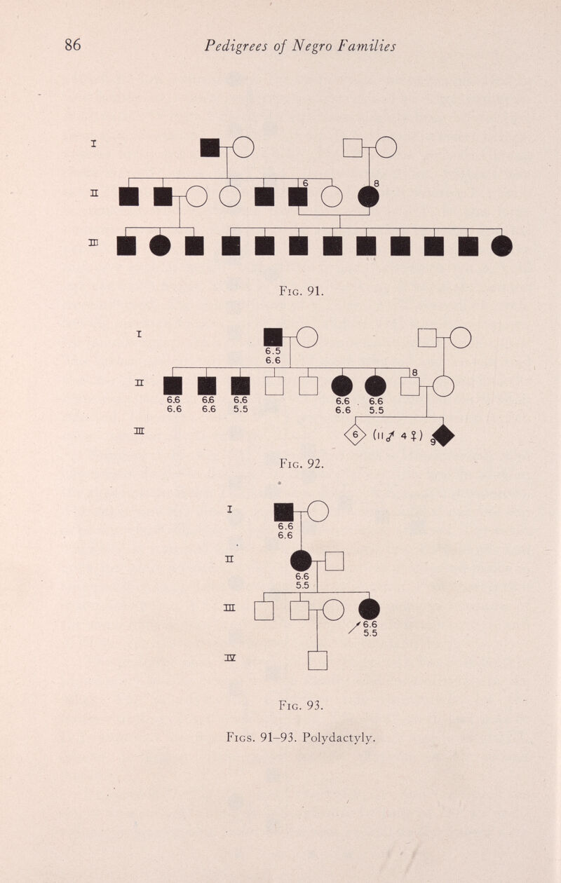 m HZ 6.6 6.6 6.6 5.5 'è y> 6.6 5.5 Fig. 93. Figs. 91-93. Polydactyly.