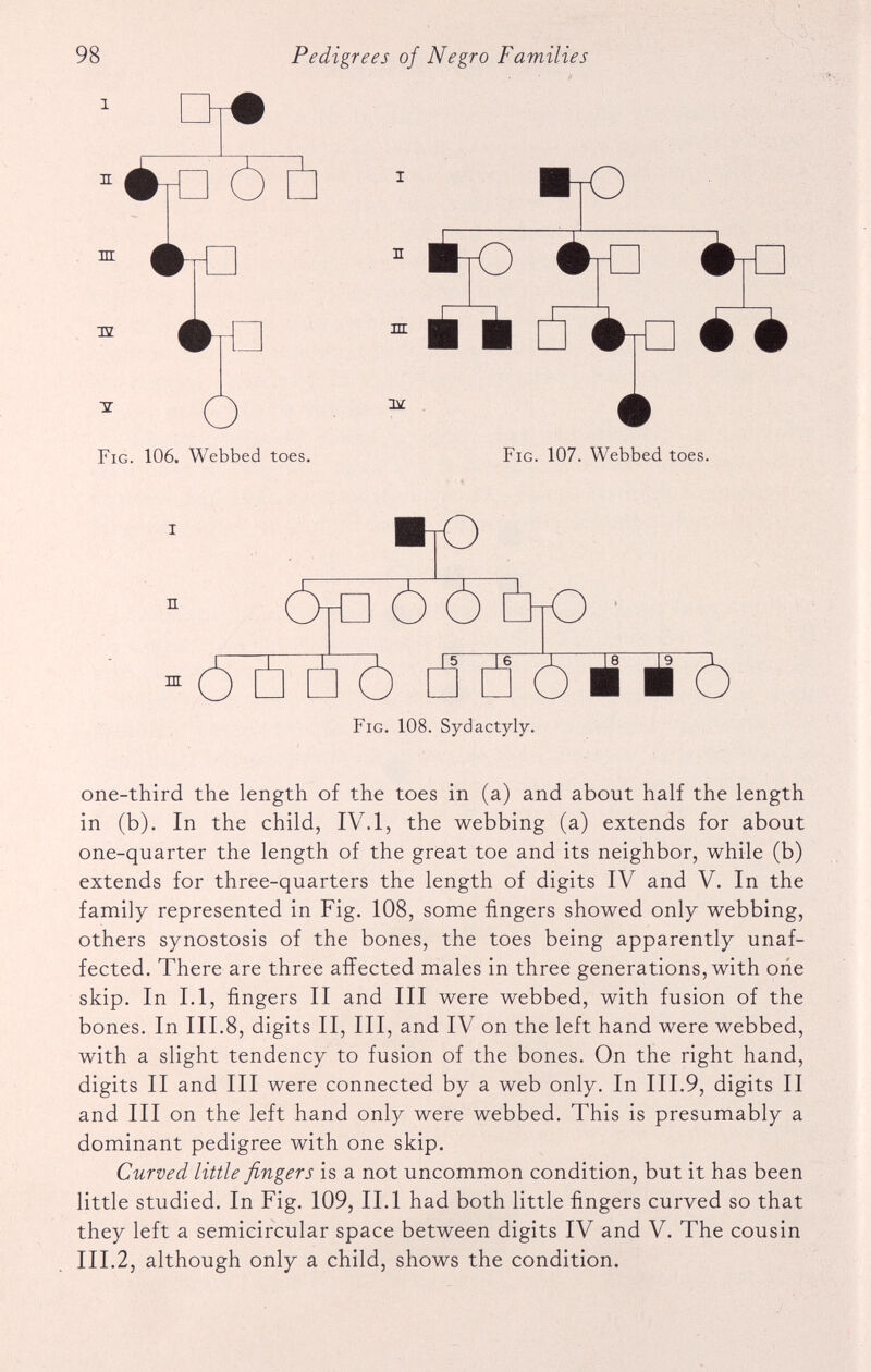 * O Fig. 106. Webbed toes. I 1 ijo M H B SSL Fig. 107. Webbed toes. Fig. 108. Sydactyly. one-third the length of the toes in (a) and about half the length in (b). In the child, IV. 1, the webbing (a) extends for about one-quarter the length of the great toe and its neighbor, while (b) extends for three-quarters the length of digits IV and V. In the family represented in Fig. 108, some fingers showed only webbing, others synostosis of the bones, the toes being apparently unaf fected. There are three affected males in three generations, with one skip. In 1.1, fingers II and III were webbed, with fusion of the bones. In III.8, digits II, III, and IV on the left hand were webbed, with a slight tendency to fusion of the bones. On the right hand, digits II and III were connected by a web only. In III.9, digits II and III on the left hand only were webbed. This is presumably a dominant pedigree with one skip. Curved little fingers is a not uncommon condition, but it has been little studied. In Fig. 109, II.1 had both little fingers curved so that they left a semicircular space between digits IV and V. The cousin III.2, although only a child, shows the condition.