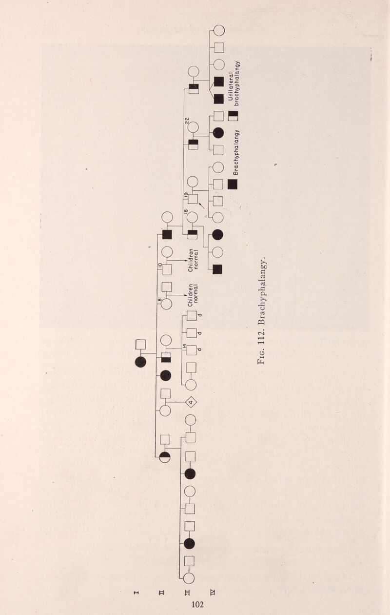 •P (^tO ÔtO é tho c5=c HD OO <â> OÙ d d d Children Children normal normal [Ihj ÏC? OhO ioè m [5¥û ■ ■ ô tTô Brachyphalangy a Unilateral brachyphalangy Fig. 112. Brachyphalangy.