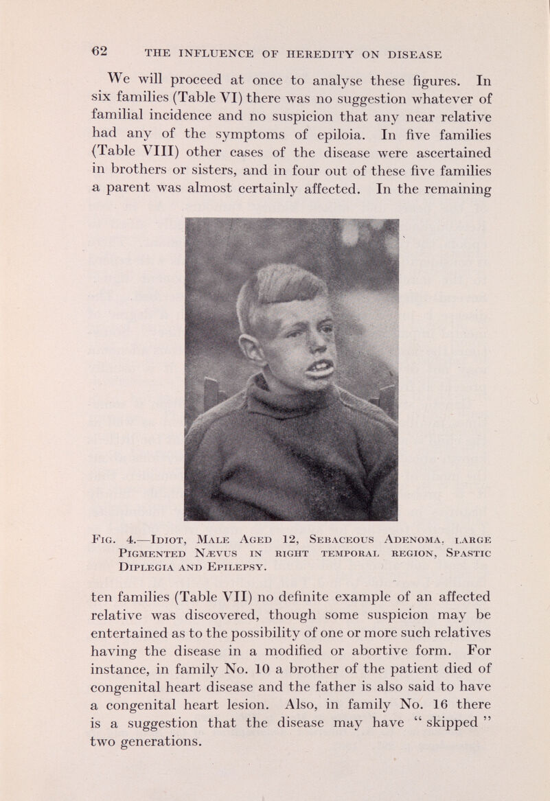 We will proceed at once to analyse these figures. In six families (Table VI) there was no suggestion whatever of familial incidence and no suspicion that any near relative had any of the symptoms of epiloia. In five families {Table VIII) other cases of the disease were ascertained in brothers or sisters, and in four out of these five families a parent was almost certainly affected. In the remaining a Fig. 4.—Idiot, Male Aged 12, Sebaceous Adenoma, large Pigmented Naevus in right temporal region. Spastic Diplegia and Epilepsy. ten families (Table VII) no definite example of an affected relative was discovered, though some suspicion may be entertained as to the possibility of one or more such relatives having the disease in a modified or abortive form. For instance, in family No. 10 a brother of the patient died of congenital heart disease and the father is also said to have a congenital heart lesion. Also, in family No. 16 there is a suggestion that the disease may have  skipped  two generations.