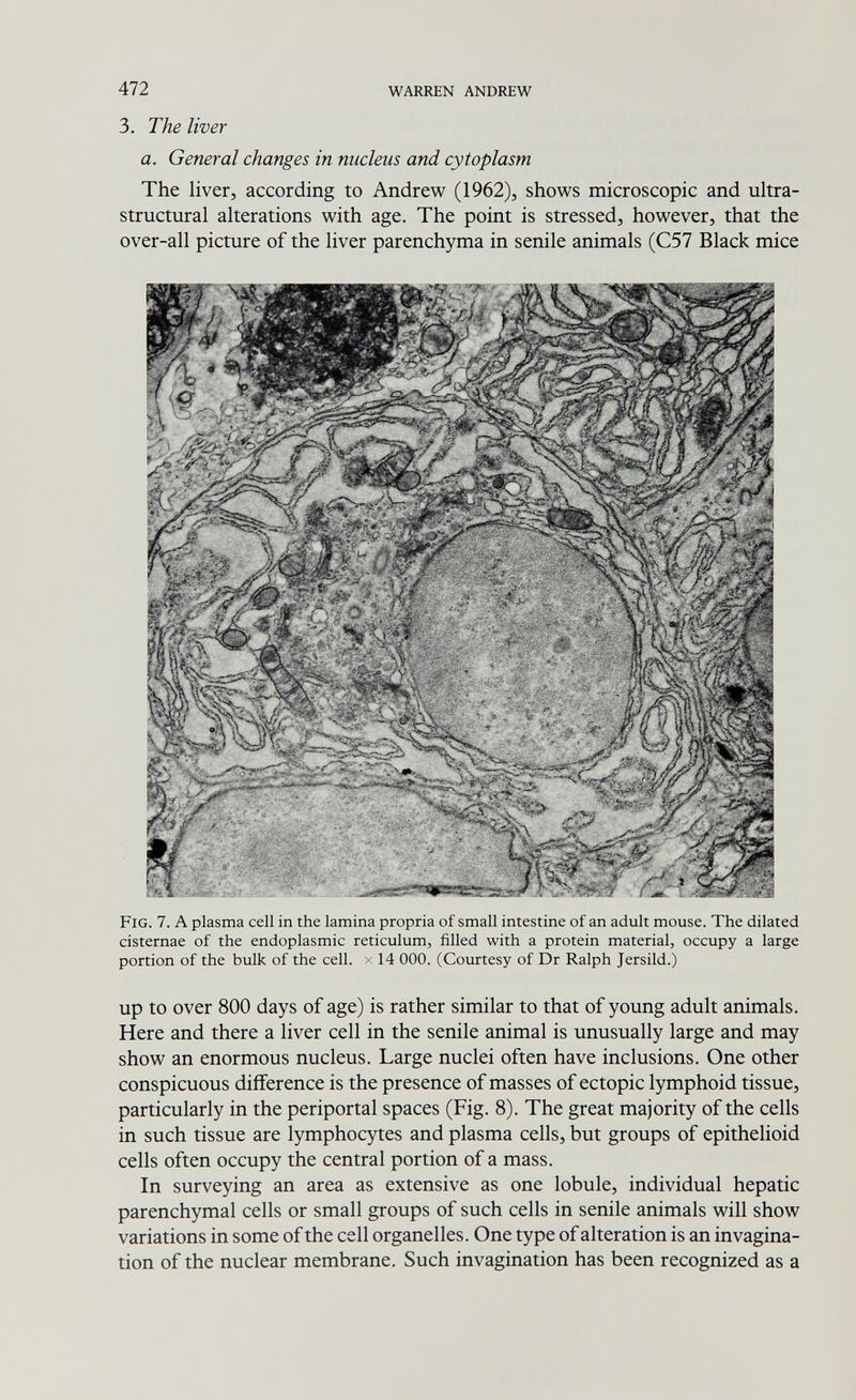 472 WARREN ANDREW 3. The liver a. General changes in nucleus and cytoplasm The liver, according to Andrew (1962), shows microscopic and ultra- structural alterations with age. The point is stressed, however, that the over-all picture of the liver parenchyma in senile animals (C57 Black mice Fig. 7. A plasma cell in the lamina propria of small intestine of an adult mouse. The dilated cisternae of the endoplasmic reticulum, filled with a protein material, occupy a large portion of the bulk of the cell, x 14 ООО. (Courtesy of Dr Ralph Jersild.) up to over 800 days of age) is rather similar to that of young adult animals. Here and there a liver cell in the senile animal is unusually large and may show an enormous nucleus. Large nuclei often have inclusions. One other conspicuous difference is the presence of masses of ectopic lymphoid tissue, particularly in the periportal spaces (Fig. 8). The great majority of the cells in such tissue are lymphocytes and plasma cells, but groups of epithelioid cells often occupy the central portion of a mass. In surveying an area as extensive as one lobule, individual hepatic parenchymal cells or small groups of such cells in senile animals will show variations in some of the cell organelles. One type of alteration is an invagina¬ tion of the nuclear membrane. Such invagination has been recognized as a