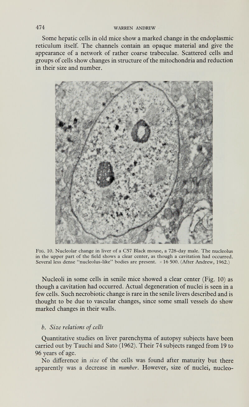 474 WARREN ANDREW Some hepatic cells in old mice show a marked change in the endoplasmic reticulum itself. The channels contain an opaque material and give the appearance of a network of rather coarse trabeculae. Scattered cells and groups of cells show changes in structure of the mitochondria and reduction in their size and number. Fig. 10. Nucleolar change in liver of a C57 Black mouse, a 728-day male. The nucleolus in the upper part of the field shows a clear center, as though a cavitation had occurred. Several less dense nucleolus-like bodies are present, x 16 500. (After Andrew, 1962.) Nucleoli in some cells in senile mice showed a clear center (Fig. 10) as though a cavitation had occurred. Actual degeneration of nuclei is seen in a few cells. Such necrobiotic change is rare in the senile livers described and is thought to be due to vascular changes, since some small vessels do show marked changes in their walls. b. Size relations of cells Quantitative studies on liver parenchyma of autopsy subjects have been carried out by Tauchi and Sato (1962). Their 74 subjects ranged from 19 to 96 years of age. No difference in size of the cells was found after maturity but there apparently was a decrease in number. However, size of nuclei, nucleo-