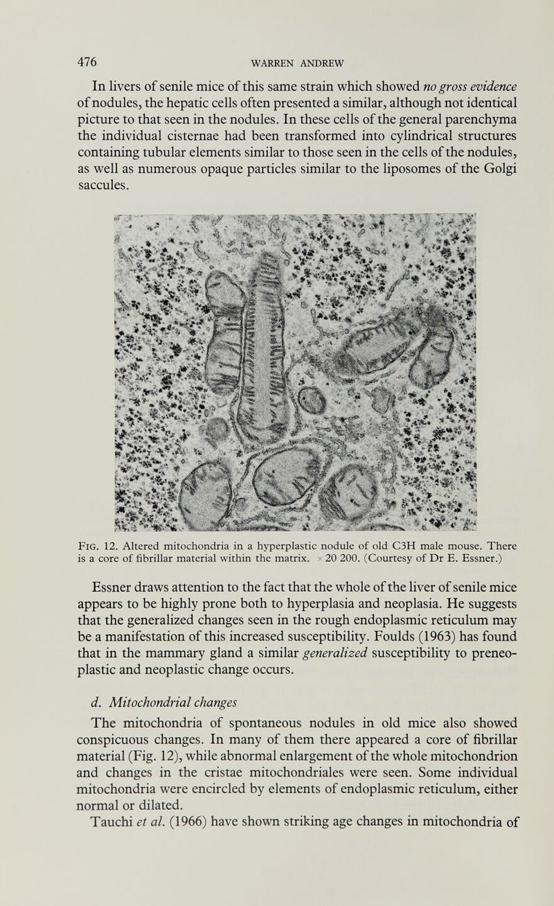 476 WARREN ANDREW In livers of senile mice of this same strain which showed no gross evidence of nodules, the hepatic cells often presented a similar, although not identical picture to that seen in the nodules. In these cells of the general parenchyma the individual cisternae had been transformed into cylindrical structures containing tubular elements similar to those seen in the cells of the nodules, as well as numerous opaque particles similar to the liposomes of the Golgi saccules. Fig. 12. Altered mitochondria in a hyperplastic nodule of old C3H male mouse. There is a core of fibrillar material within the matrix, x 20 200. (Courtesy of Dr E. Essner.) Essner draws attention to the fact that the whole of the liver of senile mice appears to be highly prone both to hyperplasia and neoplasia. He suggests that the generalized changes seen in the rough endoplasmic reticulum may be a manifestation of this increased susceptibility. Foulds (1963) has found that in the mammary gland a similar generalized susceptibility to preneo¬ plastic and neoplastic change occurs. d. Mitochondrial changes The mitochondria of spontaneous nodules in old mice also showed conspicuous changes. In many of them there appeared a core of fibrillar material (Fig. 12), while abnormal enlargement of the whole mitochondrion and changes in the cristae mitochondriales were seen. Some individual mitochondria were encircled by elements of endoplasmic reticulum, either normal or dilated. Tauchi et al. (1966) have shown striking age changes in mitochondria of