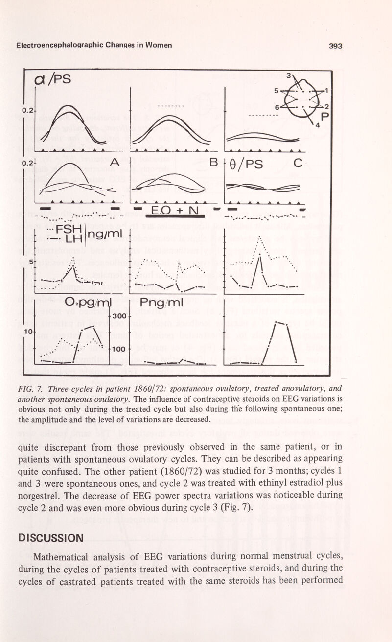 FIG. 7. Three cycles in patient 1860/72: spontaneous ovulatory, treated anovulatory, and another spontaneous ovulatory. The influence of contraceptive steroids on EEG variations is obvious not only during the treated cycle but also during the following spontaneous one; the amplitude and the level of variations are decreased. quite discrepant from those previously observed in the same patient, or in patients with spontaneous ovulatory cycles. They can be described as appearing quite confused. The other patient (1860/72) was studied for 3 months; cycles 1 and 3 were spontaneous ones, and cycle 2 was treated with ethinyl estradiol plus norgestrel. The decrease of EEG power spectra variations was noticeable during cycle 2 and was even more obvious during cycle 3 (Fig. 7). DISCUSSION Mathematical analysis of EEG variations during normal menstrual cycles, during the cycles of patients treated with contraceptive steroids, and during the cycles of castrated patients treated with the same steroids has been performed