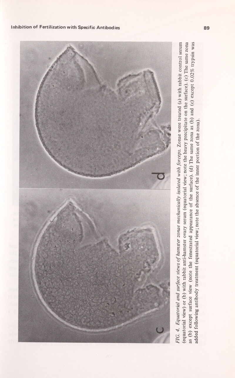 3 3 O 3 O N ÙÌ O 3 3 (/) *0 8 > 3 r+ 5 ; o O. FIG. 4. Equatorial and surface views of hamster zonae mechanically isolated with forceps. Zonae were treated (a) with rabbit control serum (equatorial view) or (b) with rabbit anti-hamster ovary serum (equatorial view; note the heavy precipitate on the surface), (c) The same zona as (b) except surface view (note the fenestrated appearance of the surface), (d) The same zona as (b) and (c) except 0.02% trypsin was added following antibody treatment (equatorial view; note the absence of the inner portion of the zona). oo (O