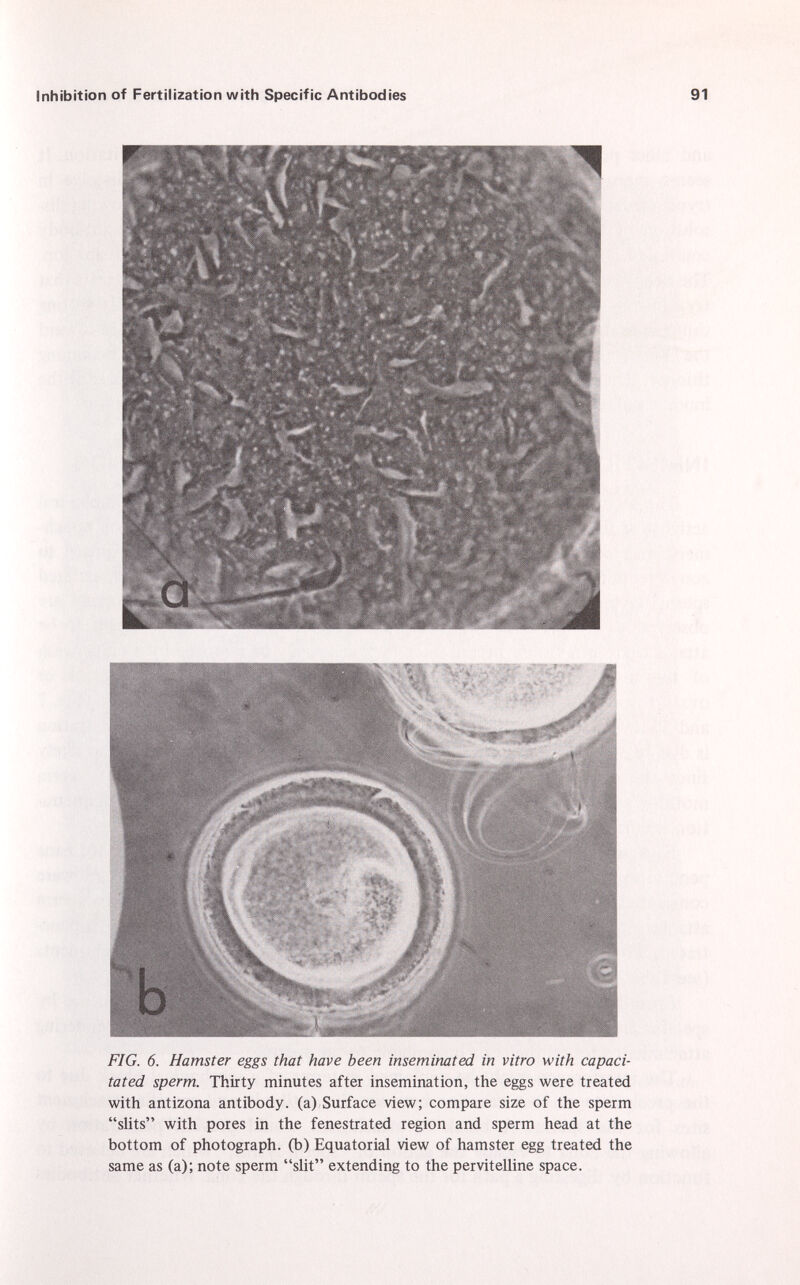 FIG. 6. Hamster eggs that have been inseminated in vitro with capaci tated sperm. Thirty minutes after insemination, the eggs were treated with antizona antibody, (a) Surface view; compare size of the sperm slits with pores in the fenestrated region and sperm head at the bottom of photograph, (b) Equatorial view of hamster egg treated the same as (a); note sperm slit extending to the pervitelline space.