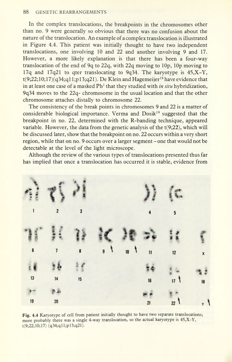 88 GENETIC REARRANGEMENTS In the complex translocations, the breakpoints in the chromosomes other than no. 9 were generally so obvious that there was no confusion about the nature of the translocation. An example of a complex translocation is illustrated in Figure 4.4. This patient was initially thought to have two independent translocations, one involving 10 and 22 and another involving 9 and 17. However, a more likely explanation is that there has been a four-way translocation of the end of 9q to 22q, with 22q moving to lOp, lOp moving to 17q and 17q21 to qter translocating to 9q34. The karyotype is 45,X-Y, t(9;22; 10; 17)(q34;q 11 ;p 13;q21 ). De Klein and Hagemeijer' ^ have evidence that in at least one case of a masked Ph' that they studied with in situ hybridization, 9q34 moves to the 22q- chromosome in the usual location and that the other chromosome attaches distally to chromosome 22. The consistency of the break points in chromosomes 9 and 22 is a matter of considerable biological importance. Verma and Dosik'^ suggested that the breakpoint in no. 22, determined with the R-banding technique, appeared variable. However, the data from the genetic analysis of the t(9;22), which will be discussed later, show that the breakpoint on no. 22 occurs within a very short region, while that on no. 9 occurs over a larger segment - one that would not be detectable at the level of the light microscope. Although the review of the various types of translocations presented thus far has implied that once a translocation has occurred it is stable, evidence from * *# t % Ш ti 13 f- 19 14 f Ия 20 ir » i IS to 11 16 21 ■é m f • 12 m 17 \ 22 \ 18 Fig. 4.4 Karyotype of cell from patient initially thought to have two separate translocations; more probably there was a single 4-way translocation, so the actual karyotype is 45,X-Y, t(9;22;10;17) (q34;qll;pl3;q21).