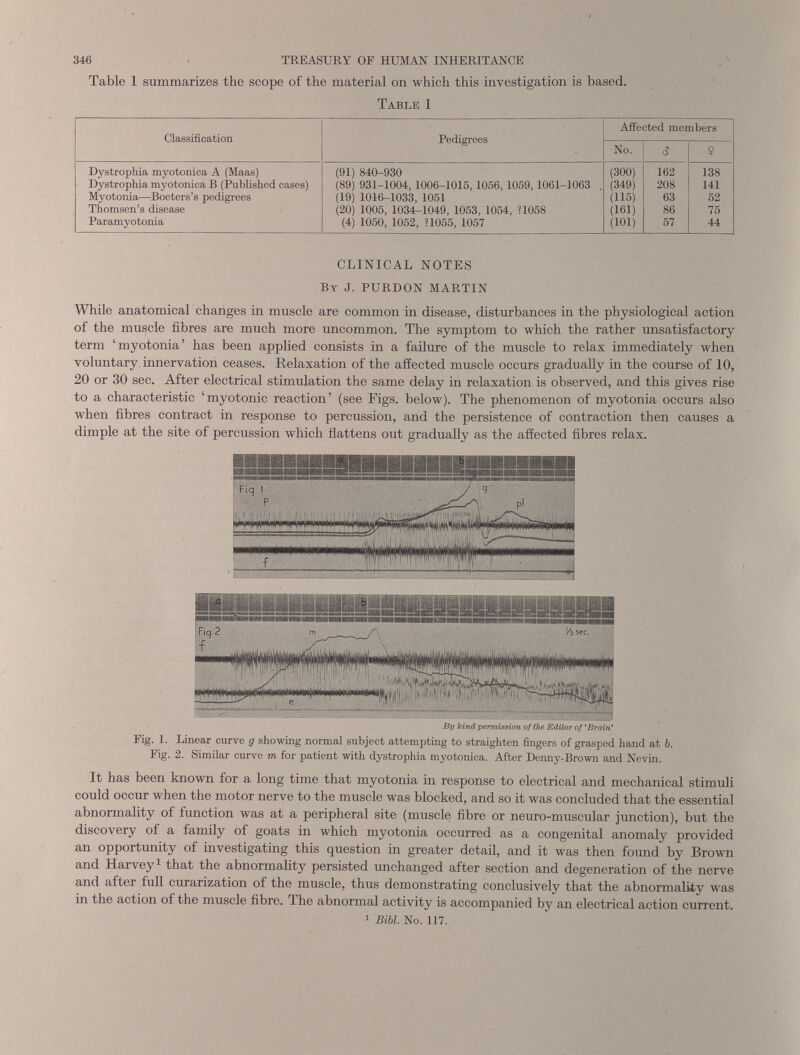 346 TREASURY OF HUMAN INHERITANCE Table 1 summarizes the scope of the material on which this investigation is based. Table 1 Classification Pedigrees Affected members No. s $ Dystrophia myotonica A (Maas) (91) 840-930 (300) 162 138 Dystrophia myotonica B (Published cases) (89) 931-1004, 1006-1015, 1056,1059,1061-1063 . (349) 208 141 Myotonia—Boeters’s pedigrees (19) 1016-1033, 1051 (115) 63 52 Thomsen’s disease (20) 1005, 1034-1049, 1053, 1054, *1058 (161) 86 75 Paramyotonia (4) 1050, 1052, *1055, 1057 (101) 57 44 CLINICAL NOTES By J. PURDON MARTIN While anatomical changes in muscle are common in disease, disturbances in the physiological action of the muscle fibres are much more uncommon. The symptom to which the rather unsatisfactory term ‘myotonia’ has been applied consists in a failure of the muscle to relax immediately when voluntary innervation ceases. Relaxation of the affected muscle occurs gradually in the course of 10, 20 or 30 sec. After electrical stimulation the same delay in relaxation is observed, and this gives rise to a characteristic ‘myotonic reaction’ (see Figs, below). The phenomenon of myotonia occurs also when fibres contract in response to percussion, and the persistence of contraction then causes a dimple at the site of percussion which flattens out gradually as the affected fibres relax. By Jcind permission of the Editor of ‘Brain* Fig. 1. Linear curve g showing normal subject attempting to straighten fingers of grasped hand at b. Fig. 2. Similar curve m for patient with dystrophia myotonica. After Denny-Brown and Nevin. It has been known for a long time that myotonia in response to electrical and mechanical stimuli could occur when the motor nerve to the muscle was blocked, and so it was concluded that the essential abnormality of function was at a peripheral site (muscle fibre or neuro-muscular junction), but the discovery of a family of goats in which myotonia occurred as a congenital anomaly provided an opportunity of investigating this question in greater detail, and it was then found by Brown and Harvey 1 that the abnormality persisted unchanged after section and degeneration of the nerve and after full curarization of the muscle, thus demonstrating conclusively that the abnormality was in the action of the muscle fibre. The abnormal activity is accompanied by an electrical action current. 1 Bibl. No. 117.