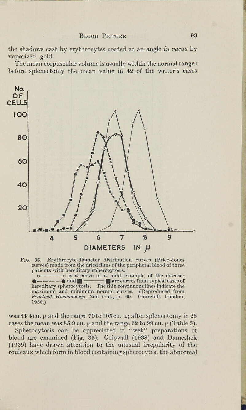 the shadows cast by erythrocytes coated at an angle in vacuo by vaporized gold. The mean corpuscular volume is usually within the normal range: before splenectomy the mean value in 42 of the writer’s cases Fig. 36. Erythrocyte-diameter distribution curves (Price-Jones curves) made from the dried films of the peripheral blood of three patients with hereditary spherocytosis. o o is a curve of a mild example of the disease; • • and H : | are curves from typical cases of hereditary spherocytosis. The thin continuous lines indicate the maximum and minimum normal curves. (Reproduced from Practical Haematology, 2nd edn., p. 60. Churchill, London, 1956.) was 84-4 cu. p and the range 70 to 105 cu. p; after splenectomy in 28 cases the mean was 85-9 cu. p and the range 62 to 99 cu. p (Table 5). Spherocytosis can be appreciated if “wet” preparations of blood are examined (Fig. 33). Gripwall (1938) and Dameshek (1939) have drawn attention to the unusual irregularity of the rouleaux which form in blood containing spherocytes, the abnormal