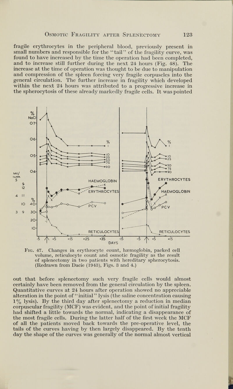 fragile erythrocytes in the peripheral blood, previously present in small numbers and responsible for the “tail” of the fragility curve, was found to have increased by the time the operation had been completed, and to increase still further during the next 24 hours (Fig. 48). The increase at the time of operation was thought to be due to manipulation and compression of the spleen forcing very fragile corpuscles into the general circulation. The further increase in fragility which developed within the next 24 hours was attributed to a progressive increase in the spherocytosis of these already markedly fragile cells. It was pointed Fig. 47. Changes in erythrocyte count, haemoglobin, packed cell volume, reticulocyte count and osmotic fragility as the result of splenectomy in two patients with hereditary spherocytosis. (Redrawn from Dacie (1943), Figs. 3 and 4.) out that before splenectomy such very fragile cells would almost certainly have been removed from the general circulation by the spleen. Quantitative curves at 24 hours after operation showed no appreciable alteration in the point of “initial” lysis (the saline concentration causing 1% lysis). By the third day after splenectomy a reduction in median corpuscular fragility (MCF) was evident, and the point of initial fragility had shifted a little towards the normal, indicating a disappearance of the most fragile cells. During the latter half of the first week the MCF of all the patients moved back towards the pre-operative level, the tails of the curves having by then largely disappeared. By the tenth day the shape of the curves was generally of the normal almost vertical