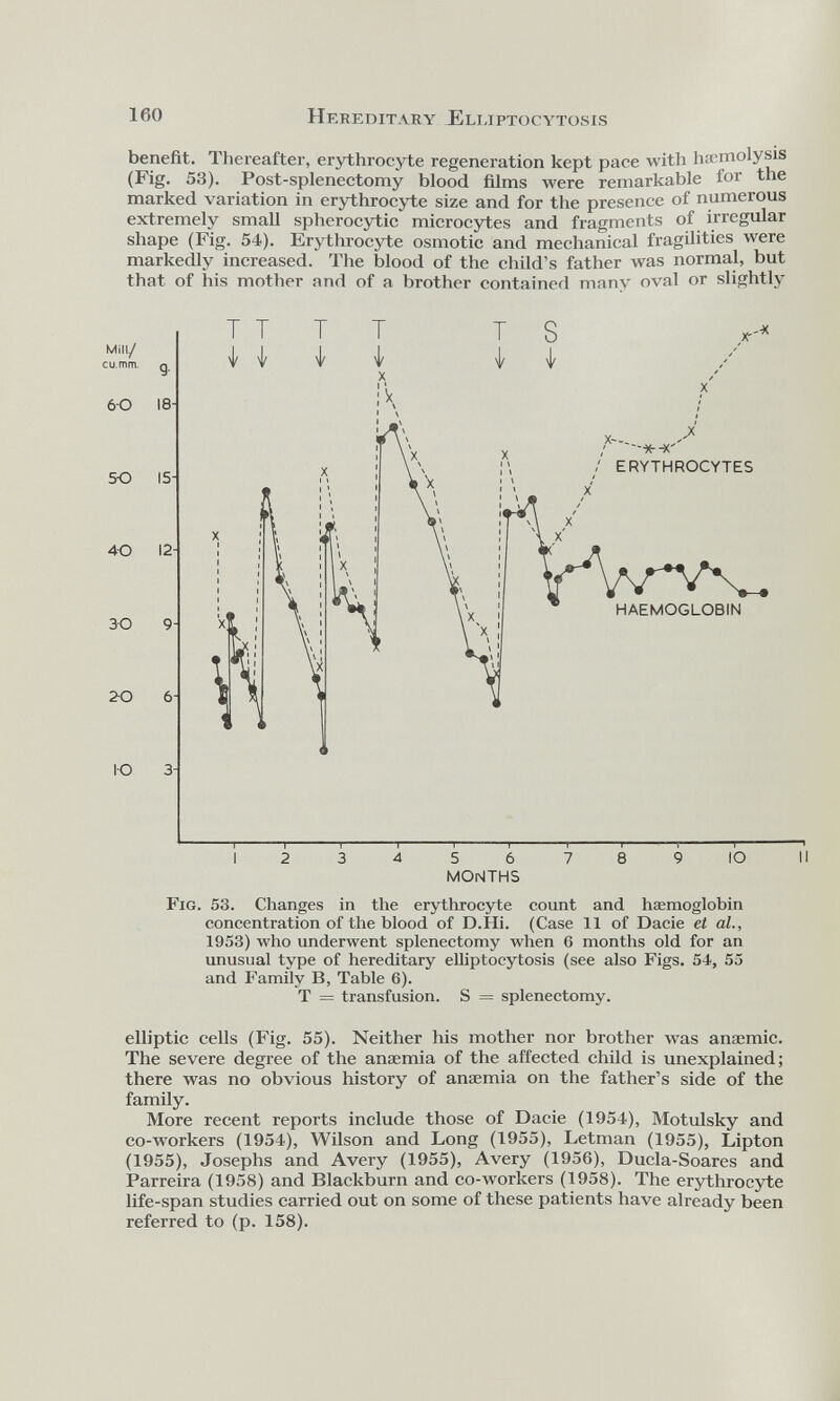 benefit. Thereafter, erythrocyte regeneration kept pace with hæmolysis (Fig. 53). Post-splenectomy blood films were remarkable for the marked variation in erythrocyte size and for the presence of numerous extremely small spherocytic microcytes and fragments of irregular shape (Fig. 54). Erythrocyte osmotic and mechanical fragilities were markedly increased. The blood of the child’s father was normal, but that of his mother and of a brother contained many oval or slightly 1 1 1 1 1 1 1 1 1 1 — 1 123456789 IO II MONTHS Fig. 53. Changes in the erythrocyte count and haemoglobin concentration of the blood of D.Hi. (Case 11 of Dacie et al., 1953) who underwent splenectomy when 6 months old for an unusual type of hereditary elliptocytosis (see also Figs. 54, 55 and Family B, Table 6). T = transfusion. S = splenectomy. elliptic cells (Fig. 55). Neither his mother nor brother was anaemic. The severe degree of the anaemia of the affected child is unexplained; there was no obvious history of anaemia on the father’s side of the family. More recent reports include those of Dacie (1954), Motulsky and co-workers (1954), Wilson and Long (1955), Letman (1955), Lipton (1955), Josephs and Avery (1955), Avery (1956), Ducla-Soares and Parreira (1958) and Blackburn and co-workers (1958). The erythrocyte life-span studies carried out on some of these patients have already been referred to (p. 158).