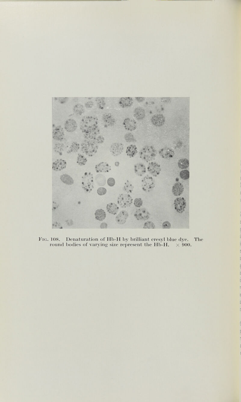 % * .'■ Fig. 108. Dénaturation of Hb-H by brilliant cresyl blue dye. The round bodies of varying size represent the Hb-H. x 900.