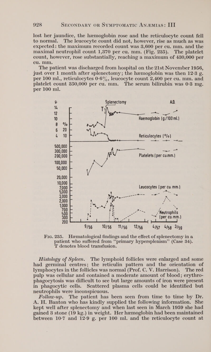 lost her jaundice, the hemoglobin rose and the reticulocyte count fell to normal. The leucocyte count did not, however, rise as much as was expected: the maximum recorded count was 3,600 per cu. mm. and the maximal neutrophil count 1,370 per cu. mm. (Fig. 235). The platelet count, however, rose substantially, reaching a maximum of 430,000 per cu. mm. The patient was discharged from hospital on the 21st November 1956, just over 1 month after splenectomy; the hemoglobin was then 12:3 g. per 100 ml., reticulocytes 0:-6%, leucocyte count 2,400 per cu. mm. and platelet count 350,000 per cu. mm. The serum bilirubin was 0-3 mg. per 100 ml. 9: Splenectomy AD. 14 T q 12 | ree = | 10 Haemoglobin (g./100 ml.) 8 %o 6 20 4 10 LA ‘ Reticulocytes (°/o) 500,000 300,000 maa oes 200,000 Platelets ( per cu.mm.} 100,000 50,000 20,000 10,000 7,000 Leucocytes | per cu. mm.) 5,000 ee Se S000 oe ee eee &gt; x 2,000 os 1,000 . 200 Neutrophils 300 ~&lt; (per cu.mm.} 200 9/56 10/56 11/56 12/56 «= 457 45g 3/59 Fic. 235. Hematological findings and the effect of splenectomy in a patient who suffered from “‘primary hypersplenism’’ (Case 34). T denotes blood transfusion. Histology of Spleen. The lymphoid follicles were enlarged and some had germinal centres; the reticulin pattern and the orientation of lymphocytes in the follicles was normal (Prof. C. V. Harrison). The red pulp was cellular and contained a moderate amount of blood; erythro- phagocytosis was difficult to see but large amounts of iron were present in phagocytic cells. Scattered plasma cells could be identified but neutrophils were inconspicuous. Follow-up. The patient has been seen from time to time by Dr. A. H. Banton who has kindly supplied the following information. She kept well after splenectomy and when last seen in March 1959 she had gained 3 stone (19 kg.) in weight. Her hemoglobin had been maintained between 10-7 and 12:9 g. per 100 ml. and the reticulocyte count at